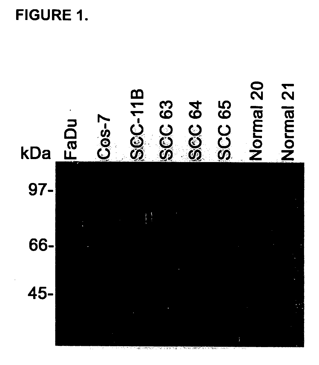 Salivary soluble CD44: a molecular marker for head and neck cancer