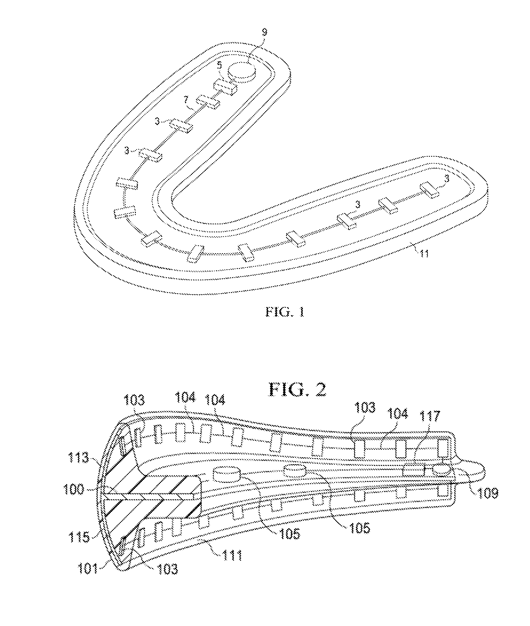 Laser orthodontic devices