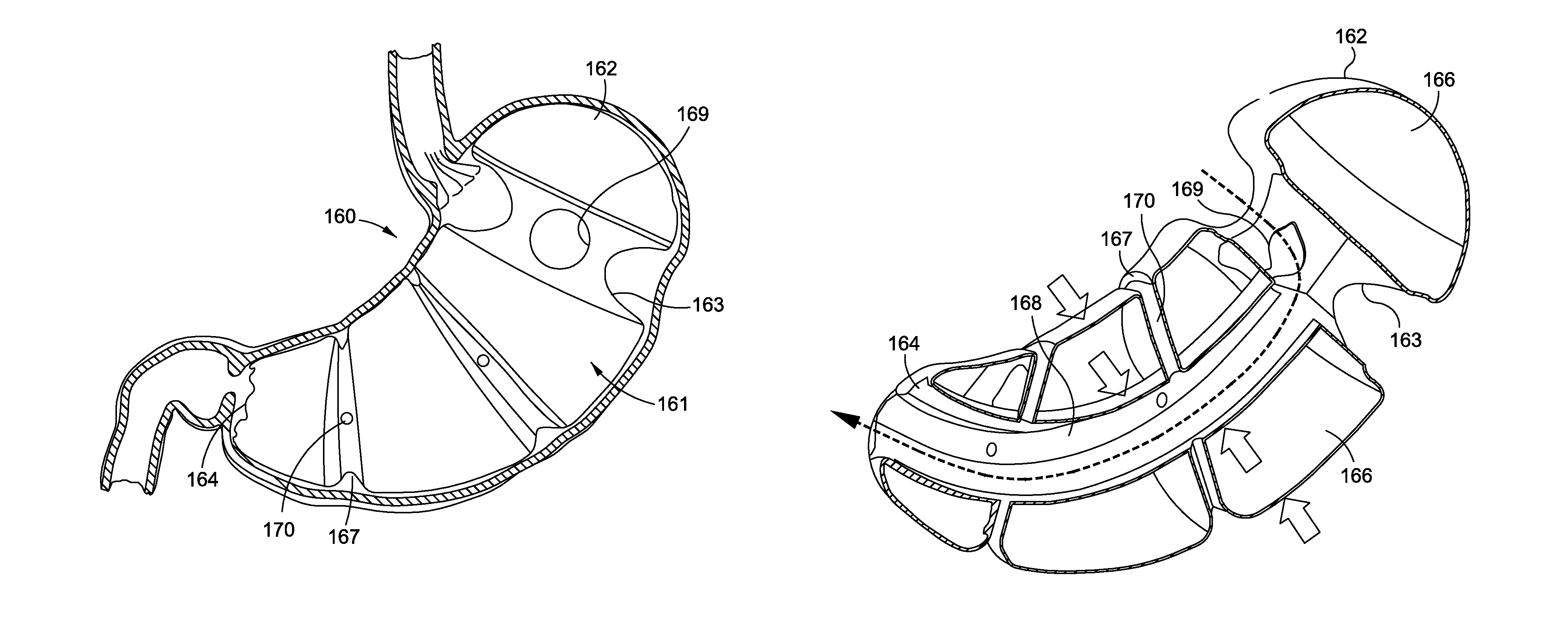 Space-filling intragastric implants with fluid flow