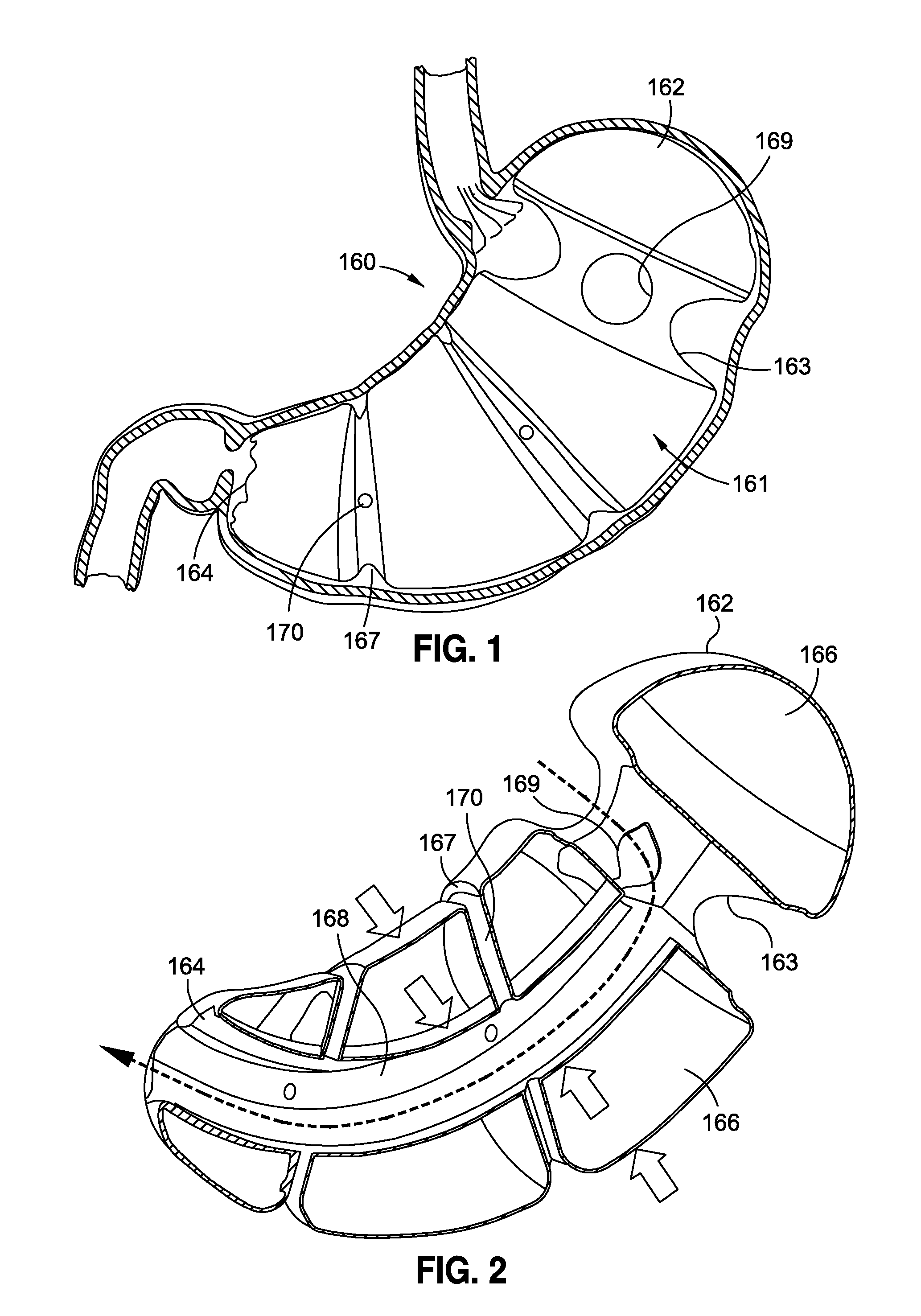 Space-filling intragastric implants with fluid flow