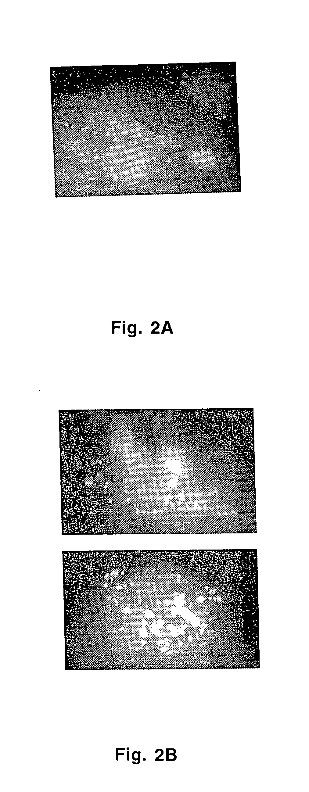 Use of mannan from saccharomyces cerevisiae for the treatment of asthma