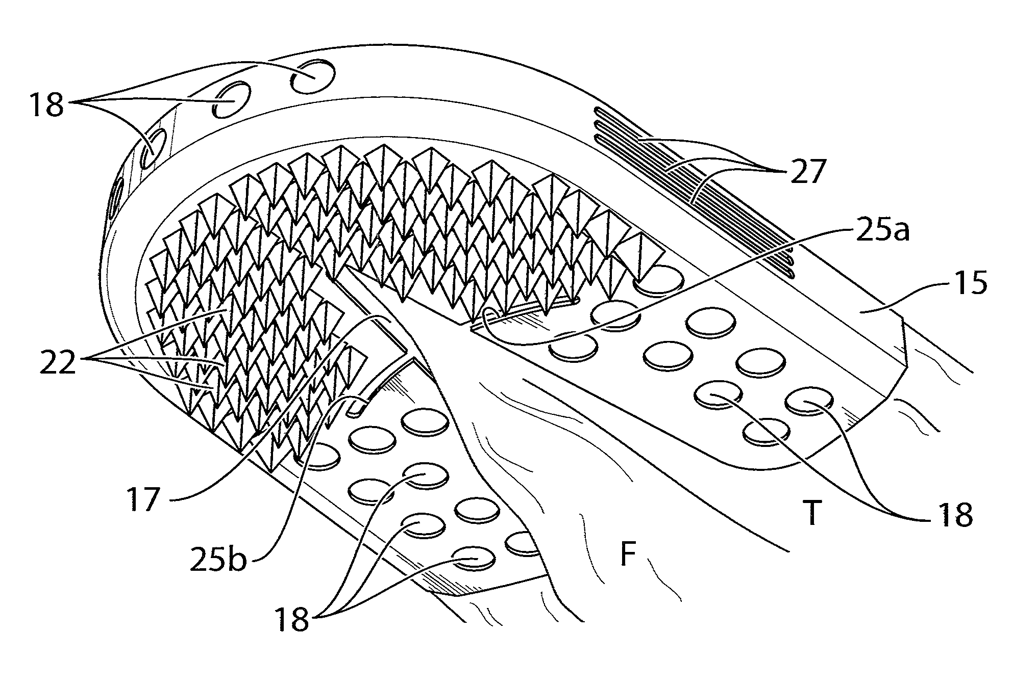 Tongue-mounted cleaning article