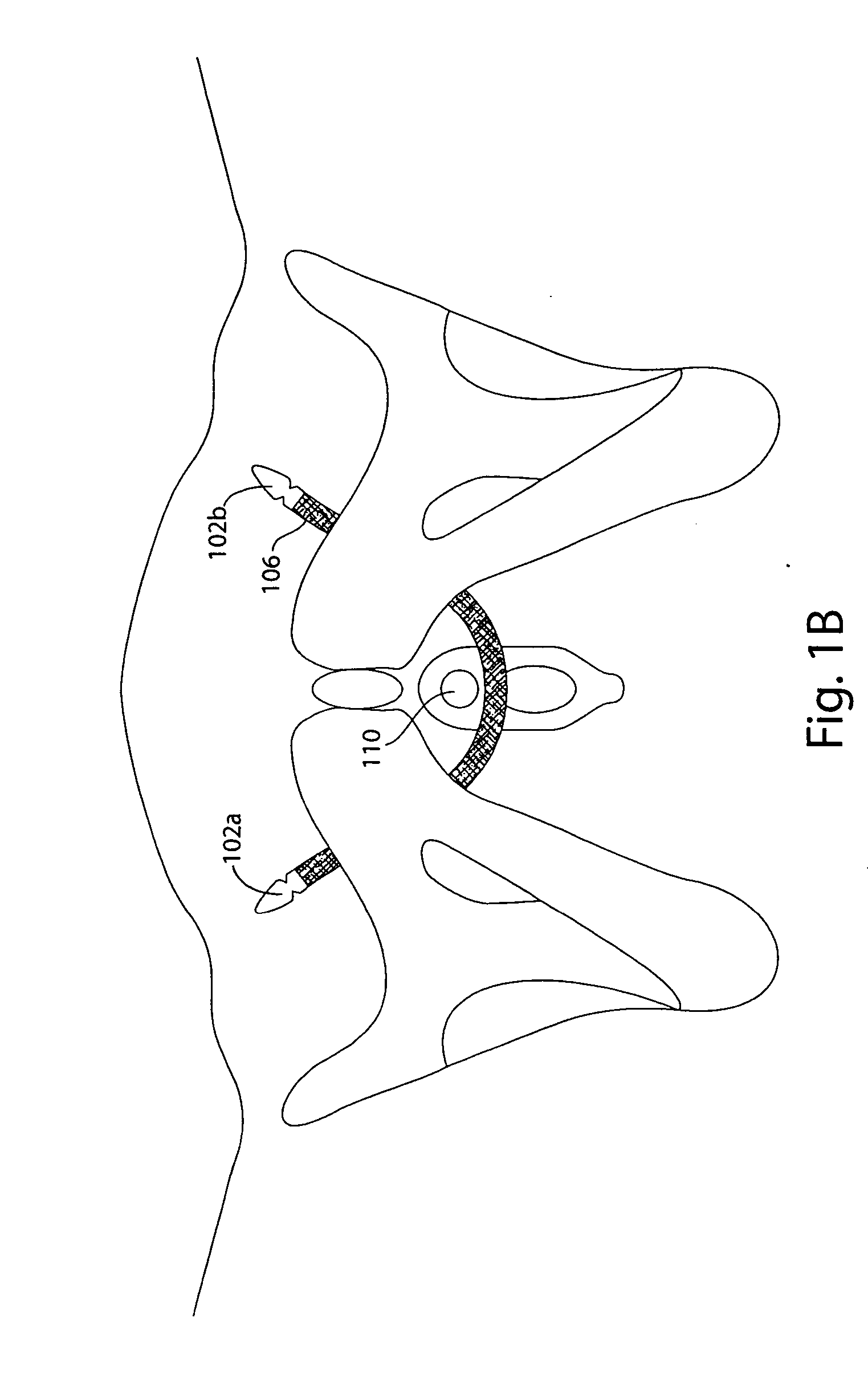 Heatable sling support for an anatomical location