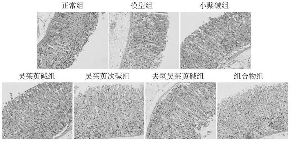 A composition for treating acute gastritis and its application