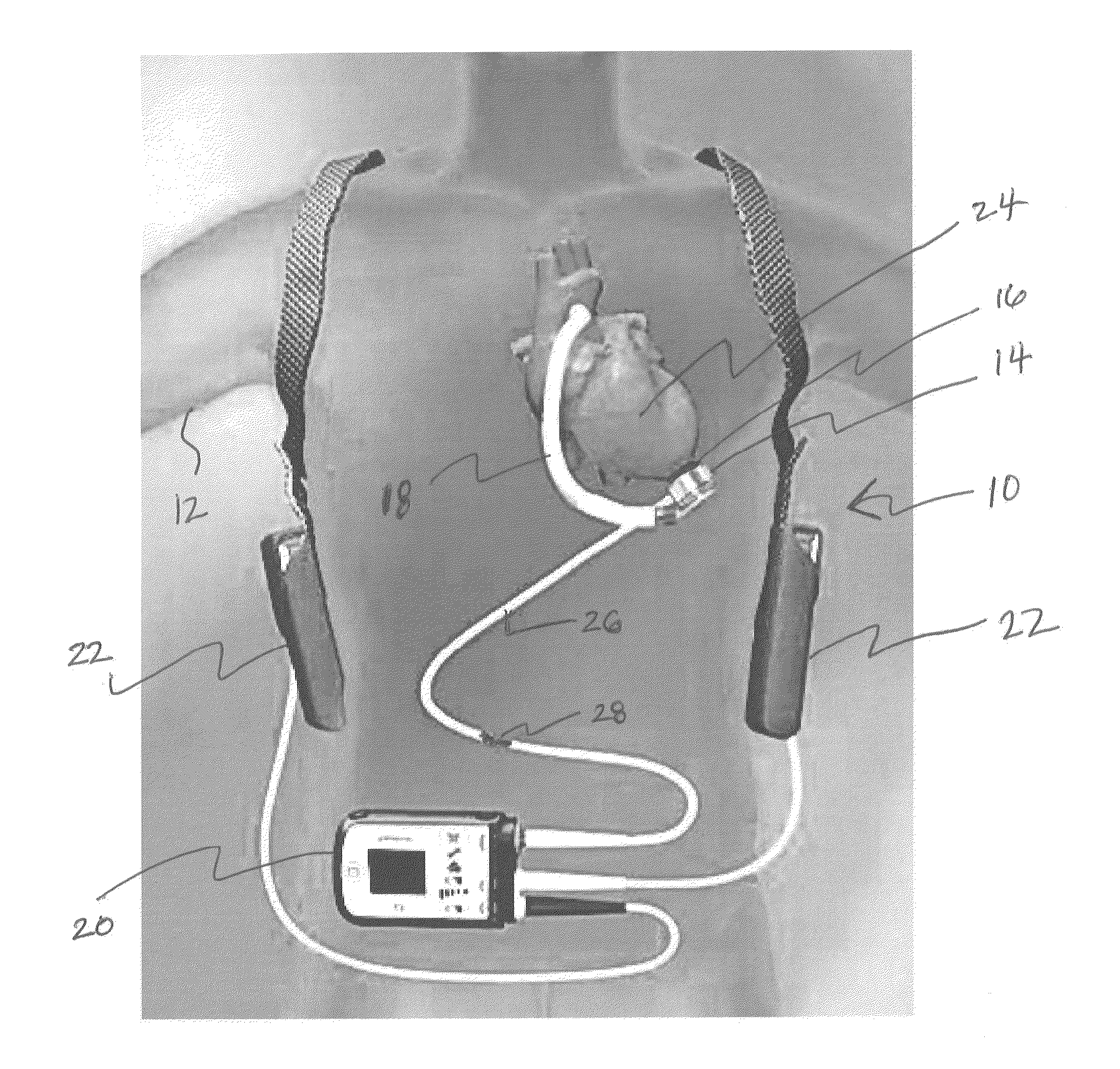 Methods and systems for lvad operation during communication losses