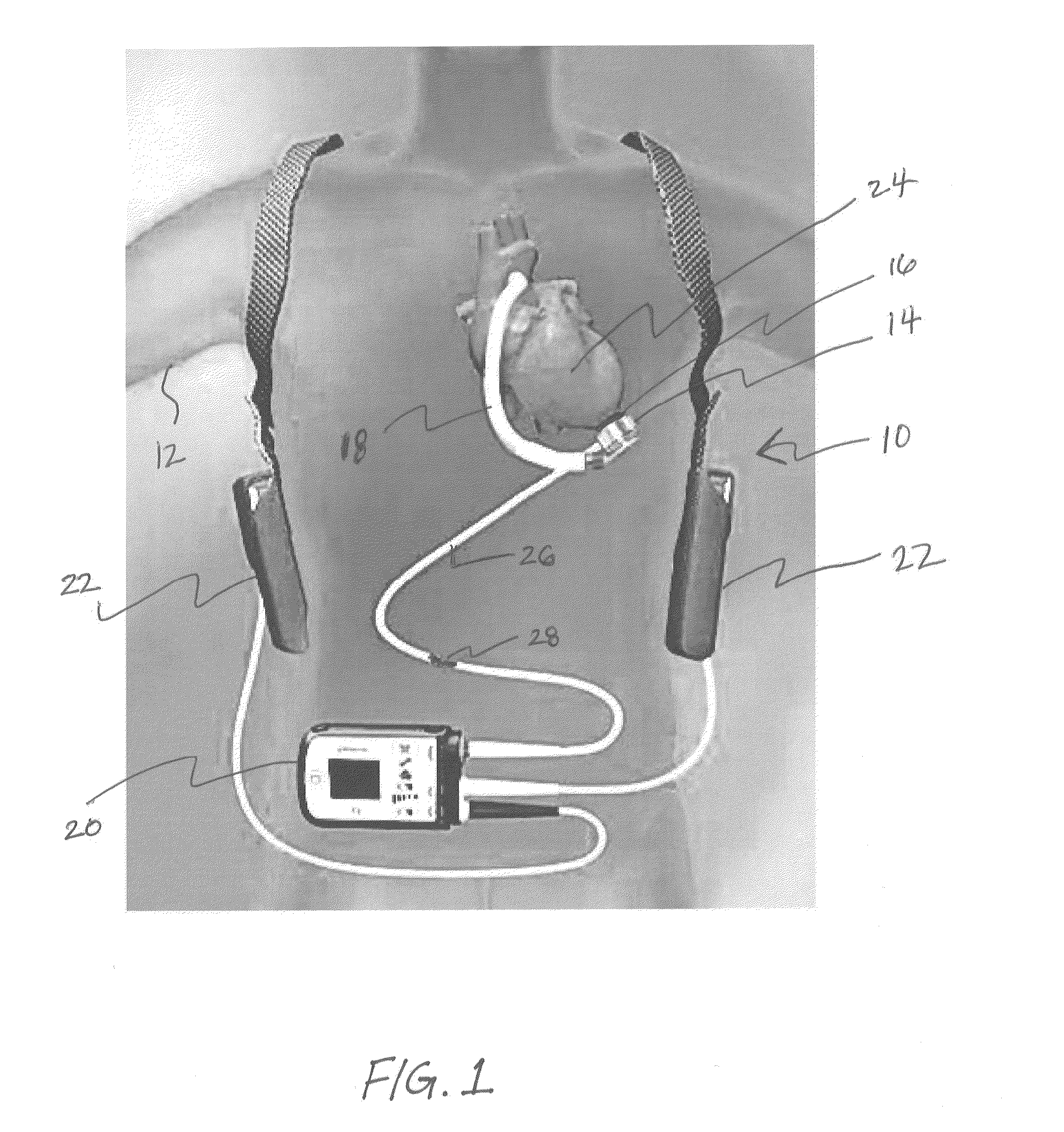 Methods and systems for lvad operation during communication losses