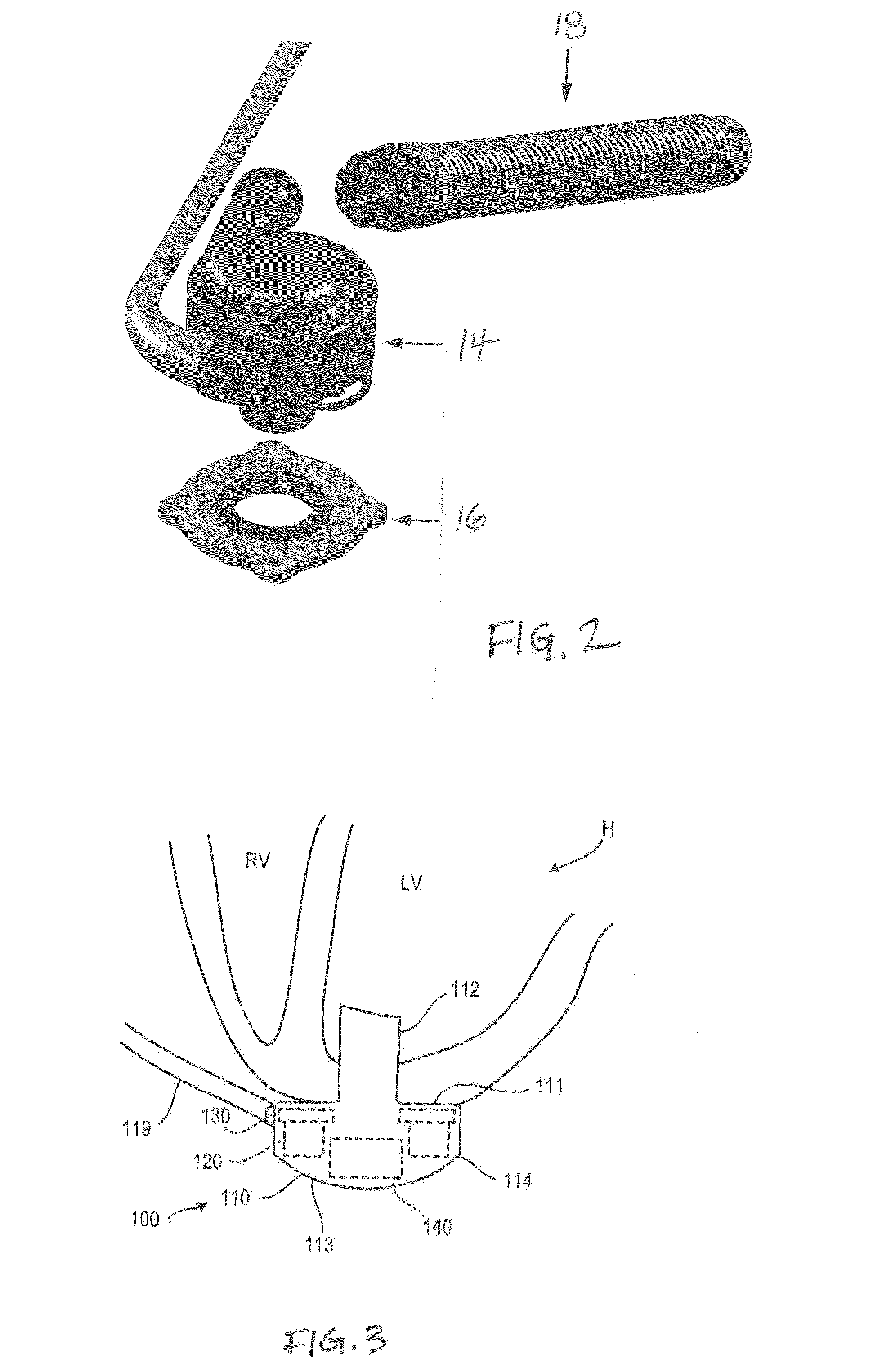 Methods and systems for lvad operation during communication losses