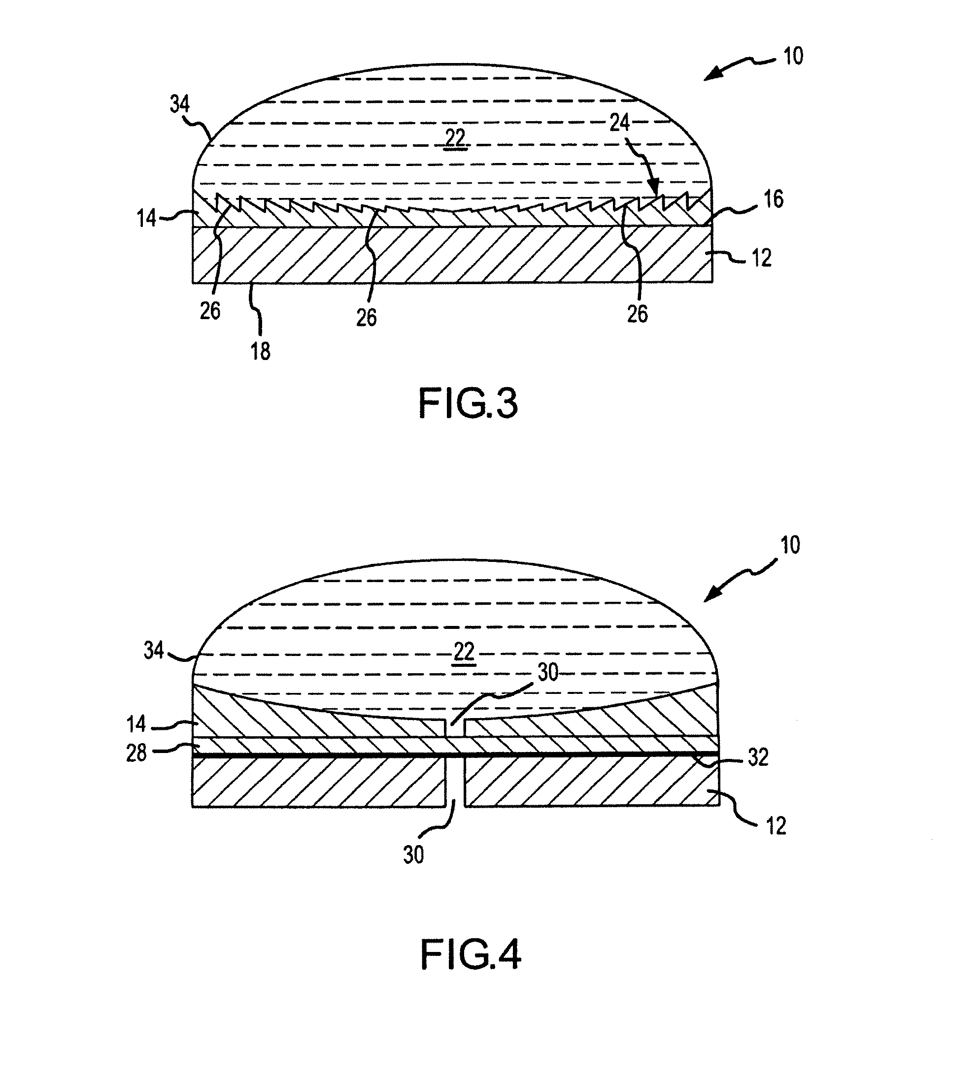 High intensity focused ultrasound transducer with acoustic lens