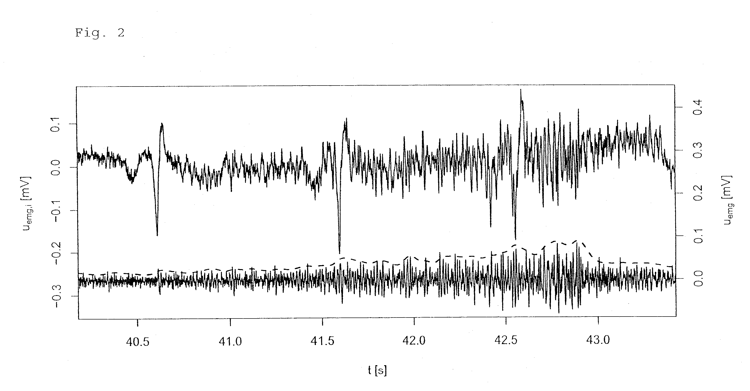 Method of automatically controlling a respiration system and a corresponding respirator