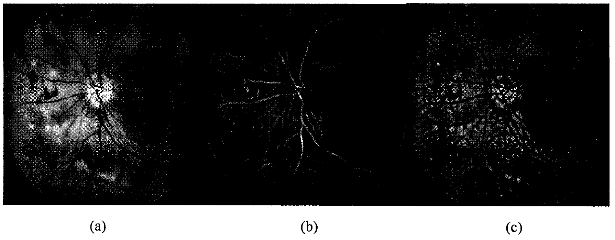 SIFT and Otsu matching based colored eyeground image splicing method