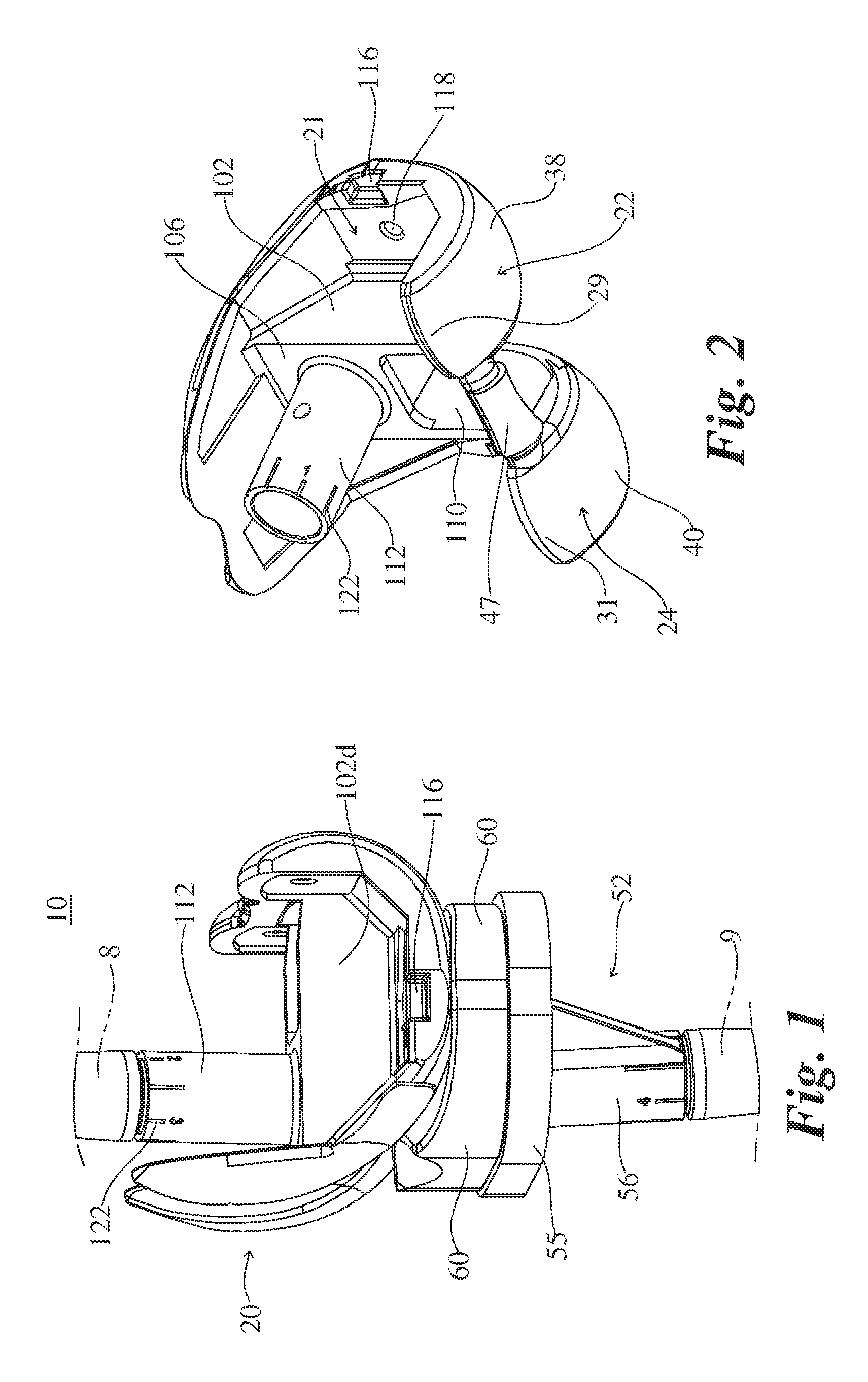 Knee Revision Prosthesis With Progressive Restraint