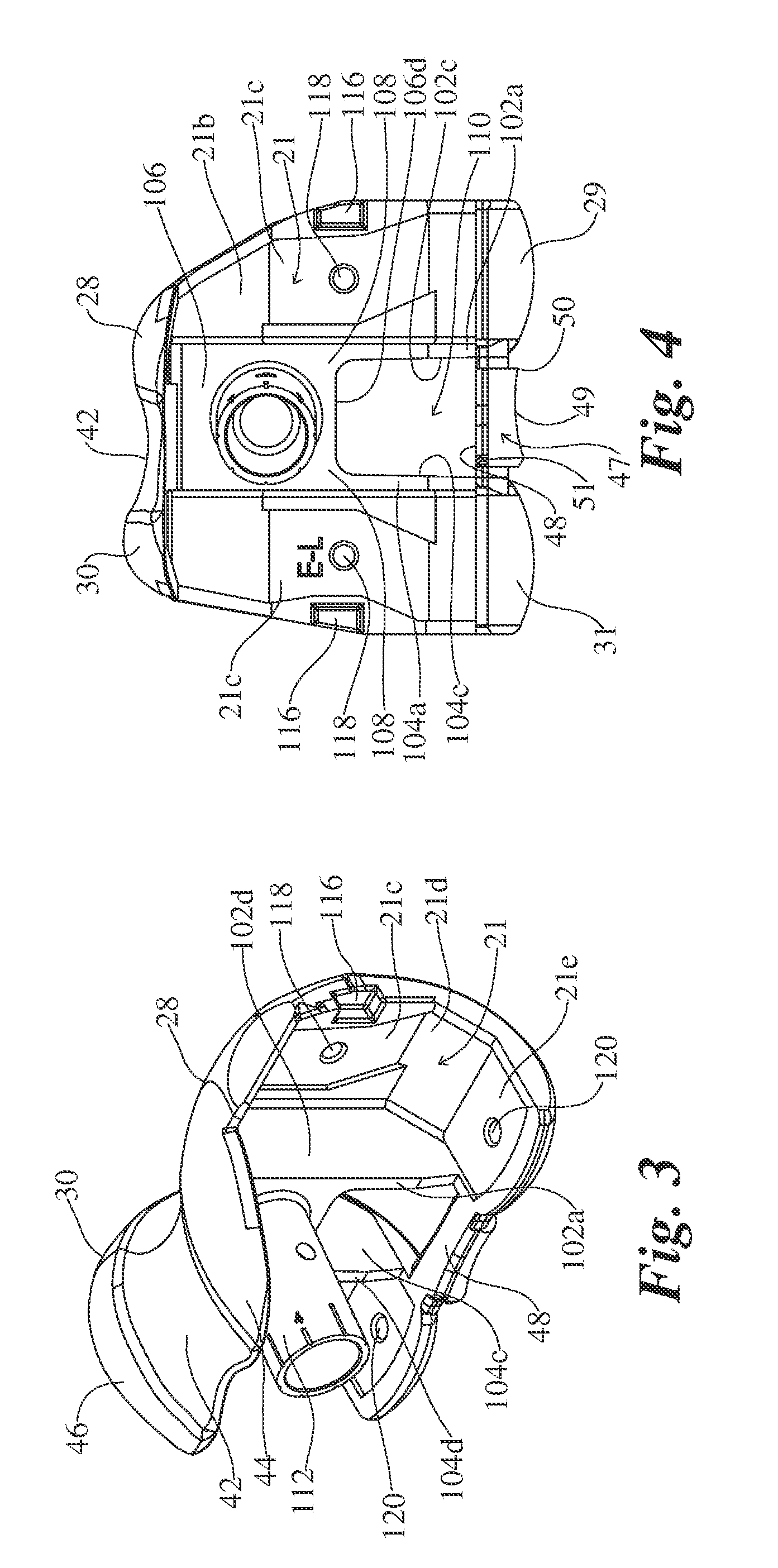 Knee Revision Prosthesis With Progressive Restraint