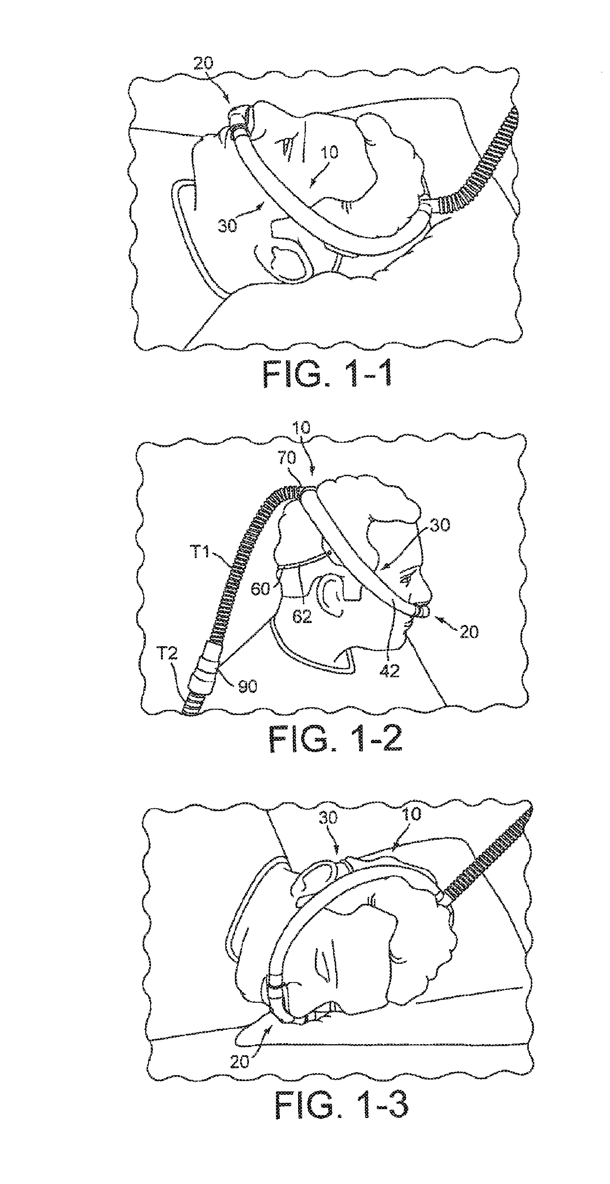 Delivery of respiratory therapy