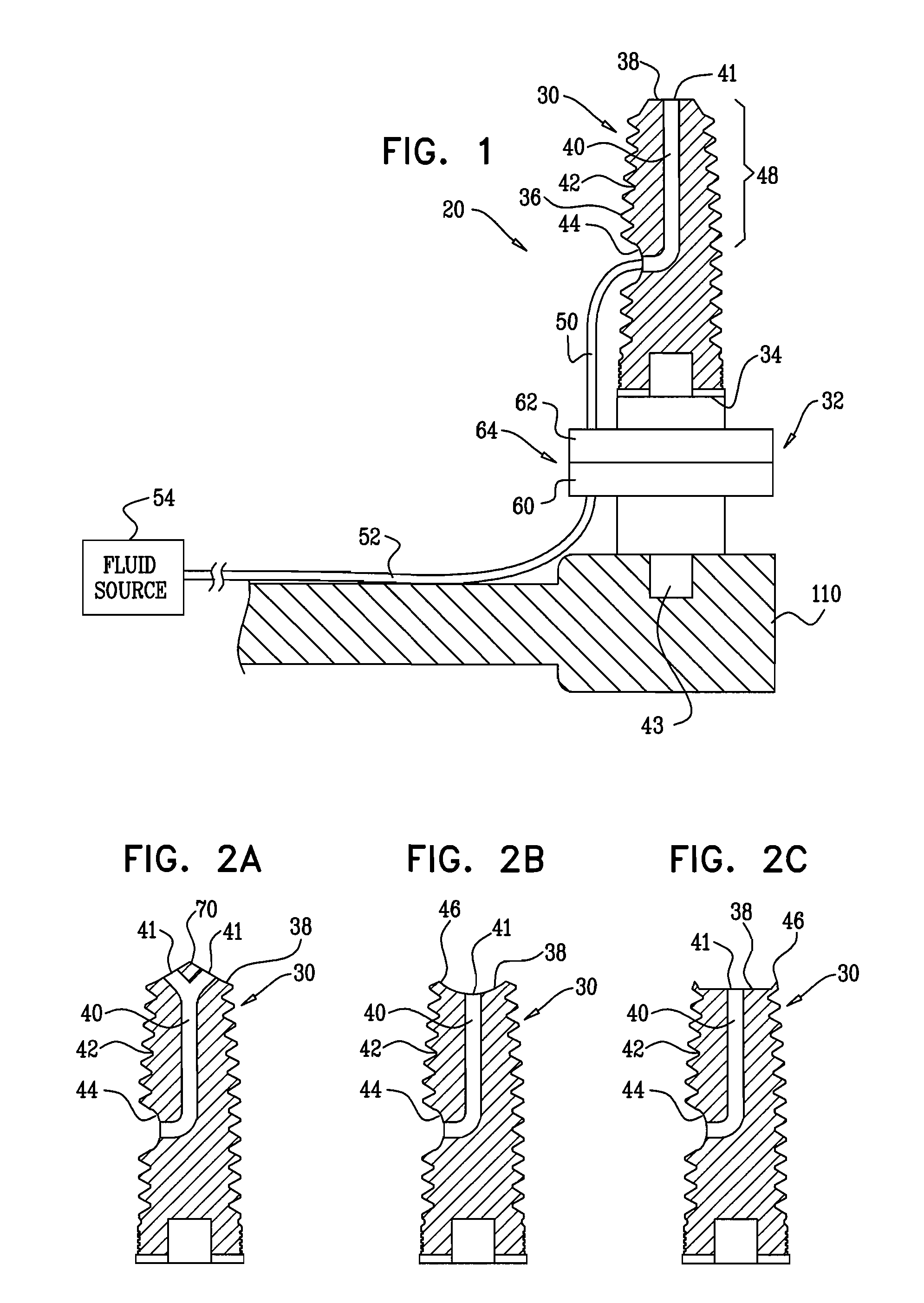 Sinus lift implant