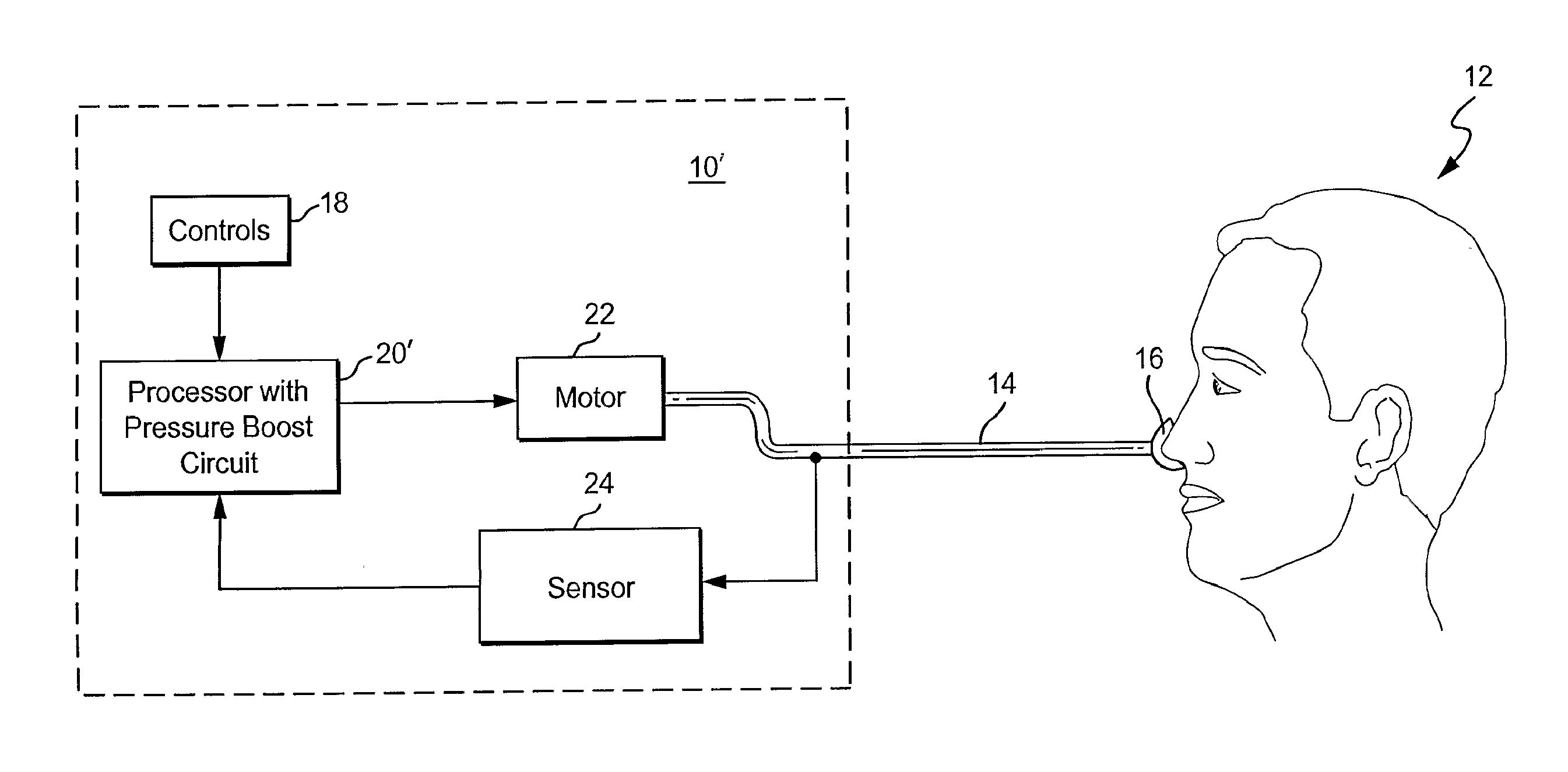 Method and apparatus for treating apnea/hypopnea