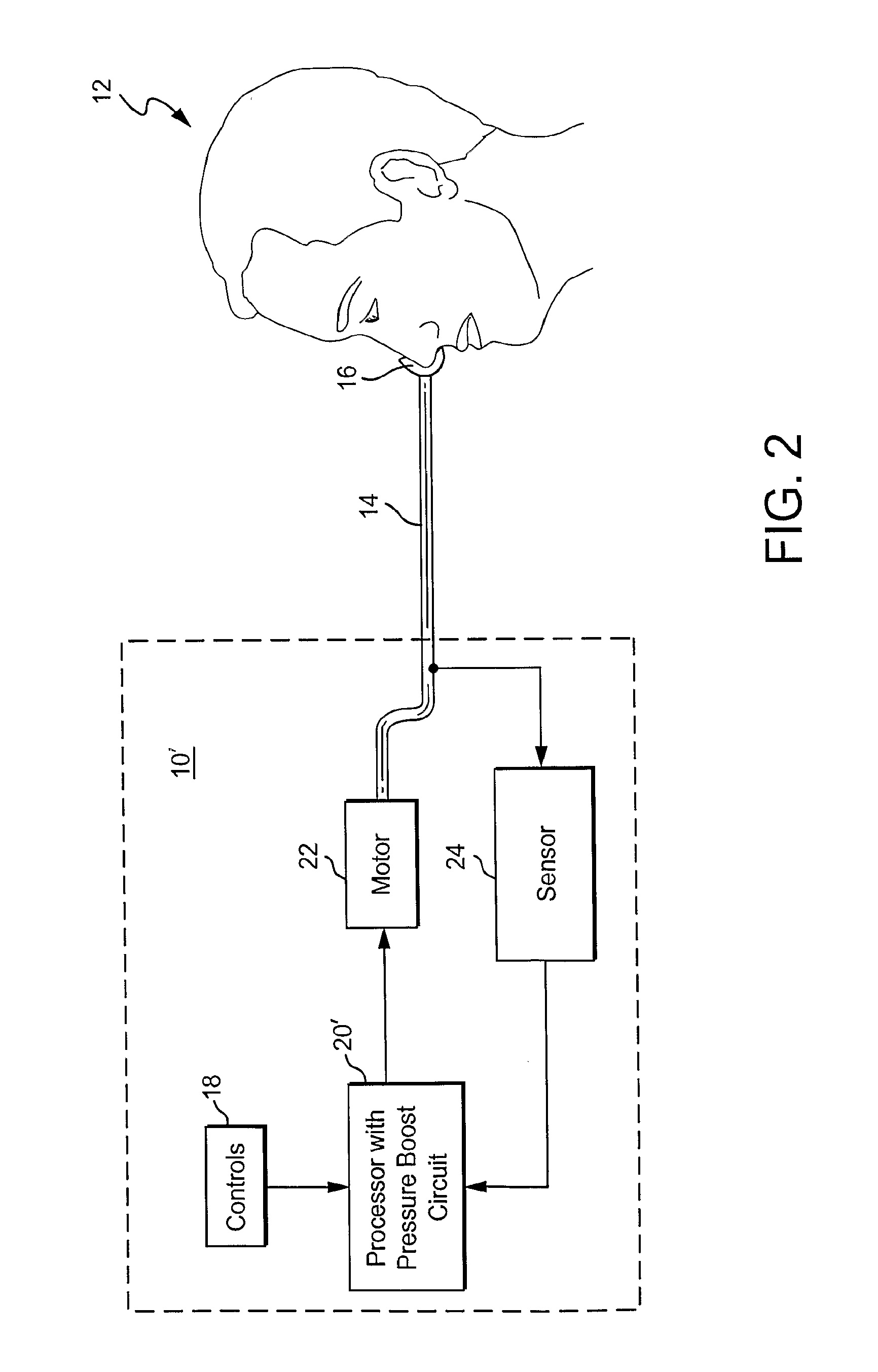 Method and apparatus for treating apnea/hypopnea