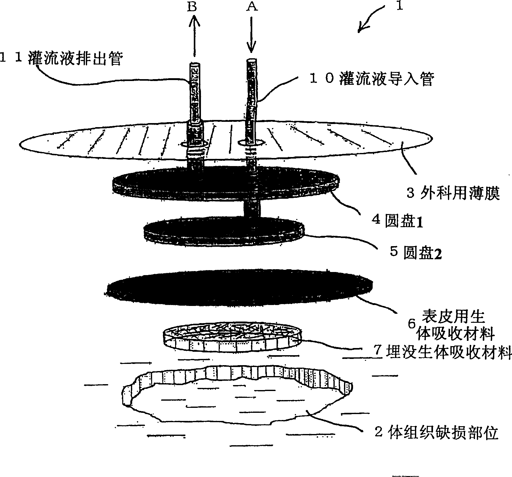 Closed cell culture system