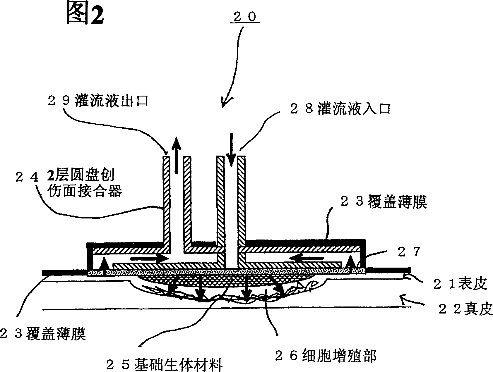 Closed cell culture system