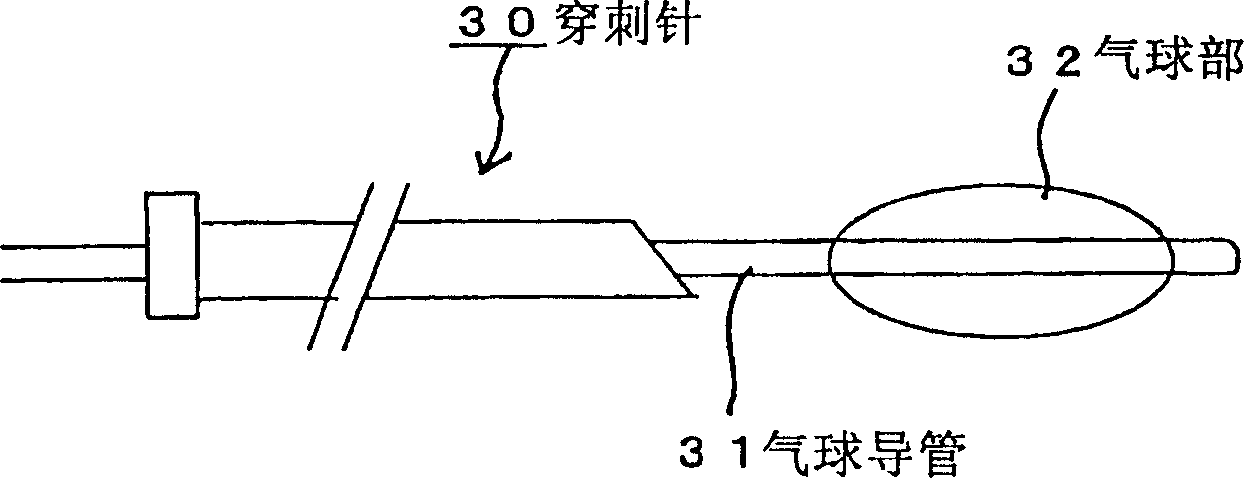 Closed cell culture system