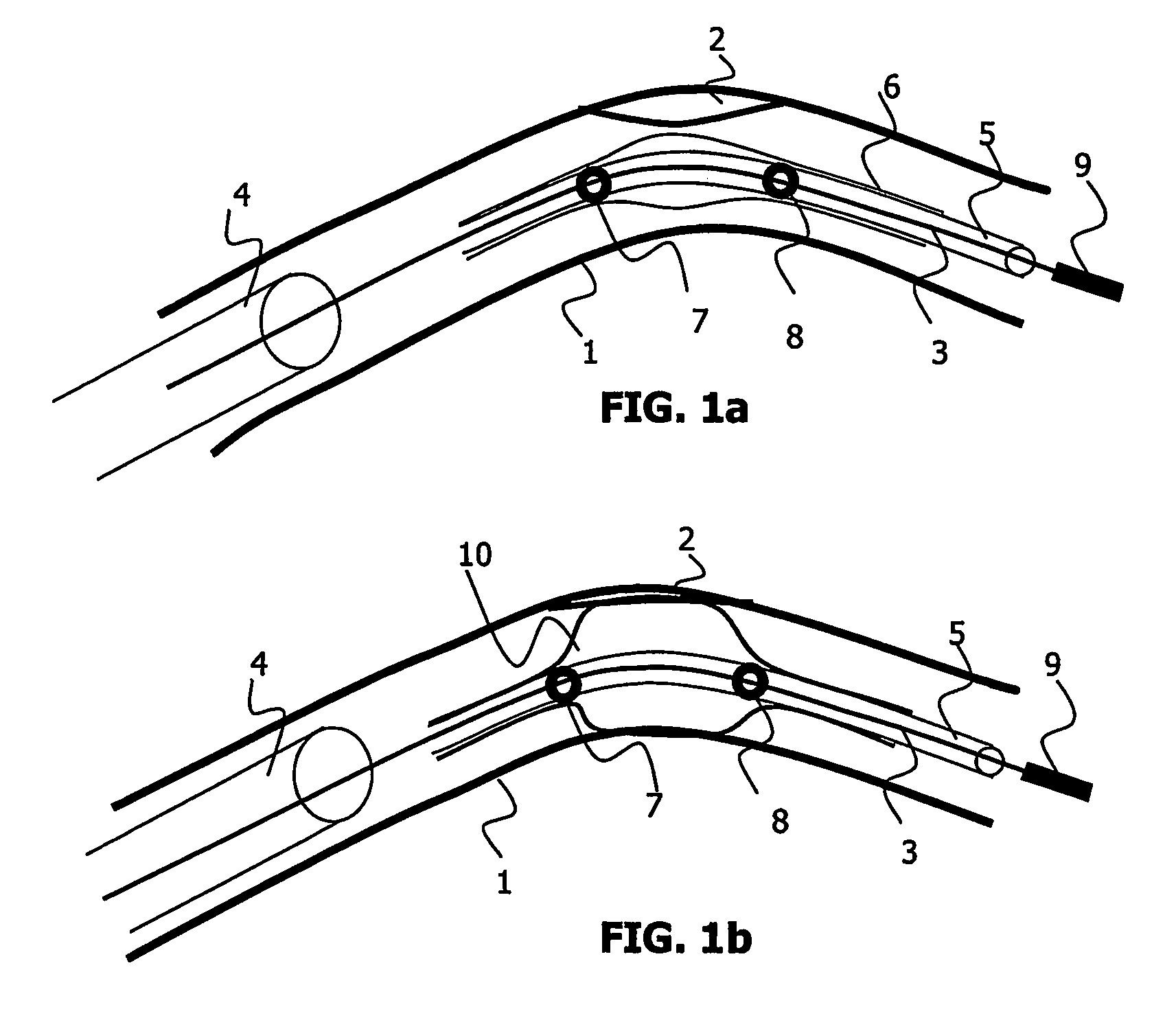 Medical viewing system and method for detecting borders of an object of interest in noisy images