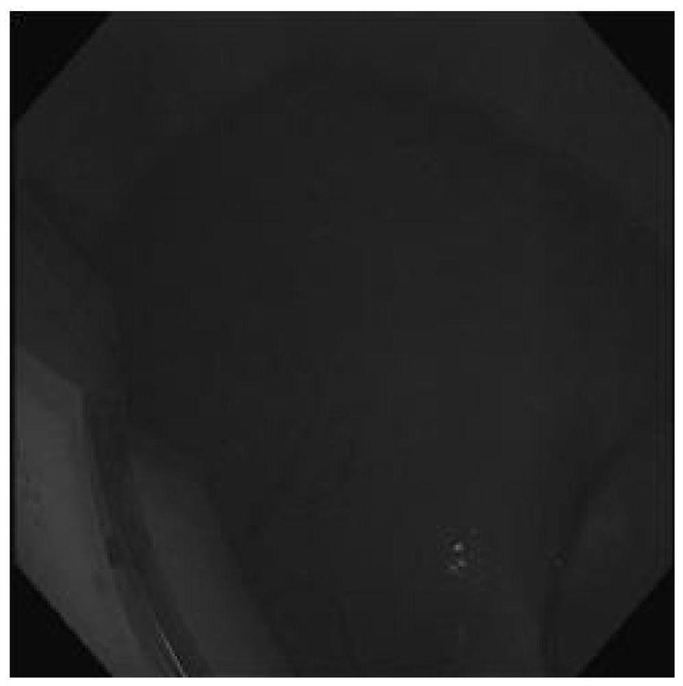 Digestive endoscopy video scene classification method based on convolutional neural network