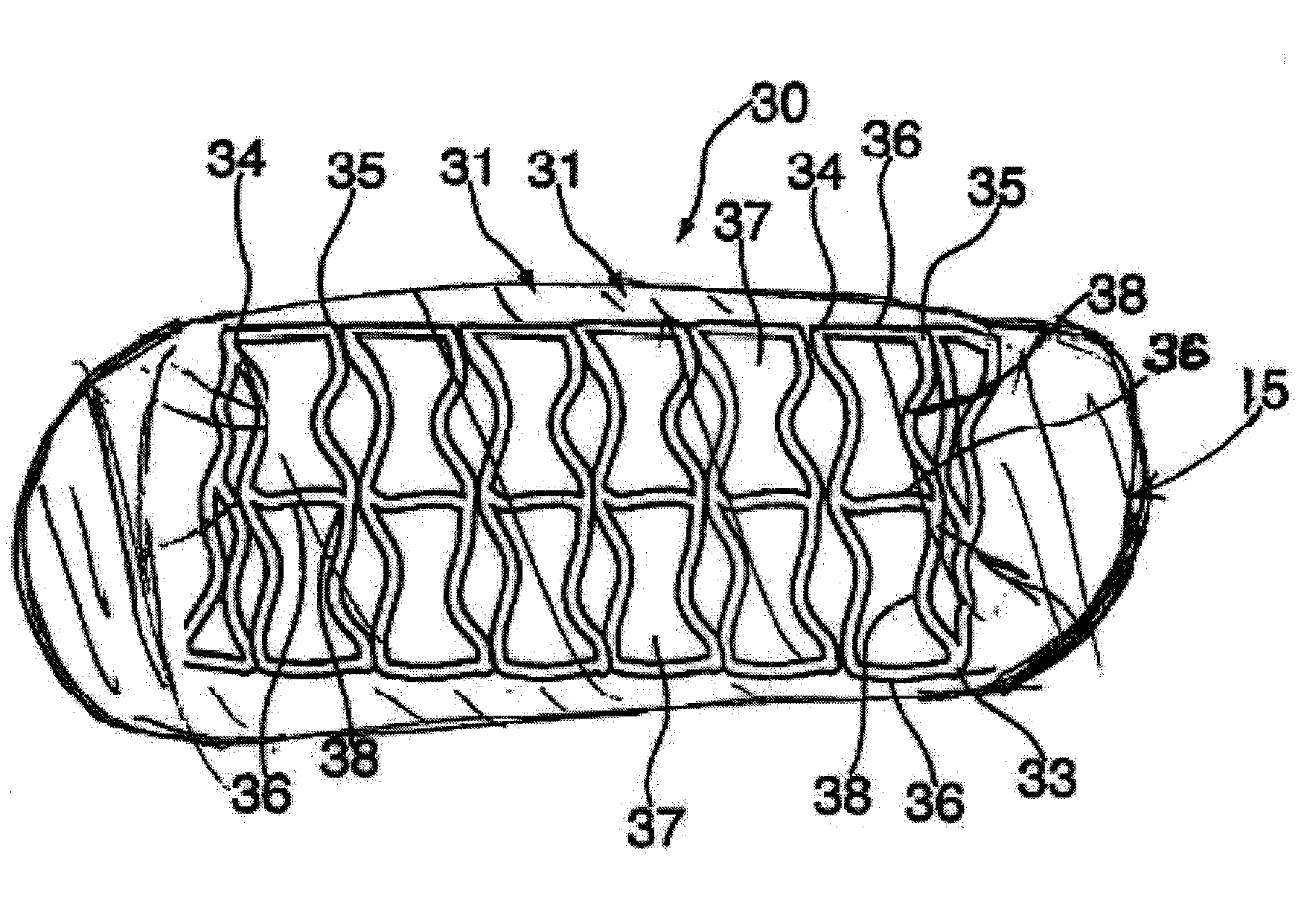 Helical hybrid stent