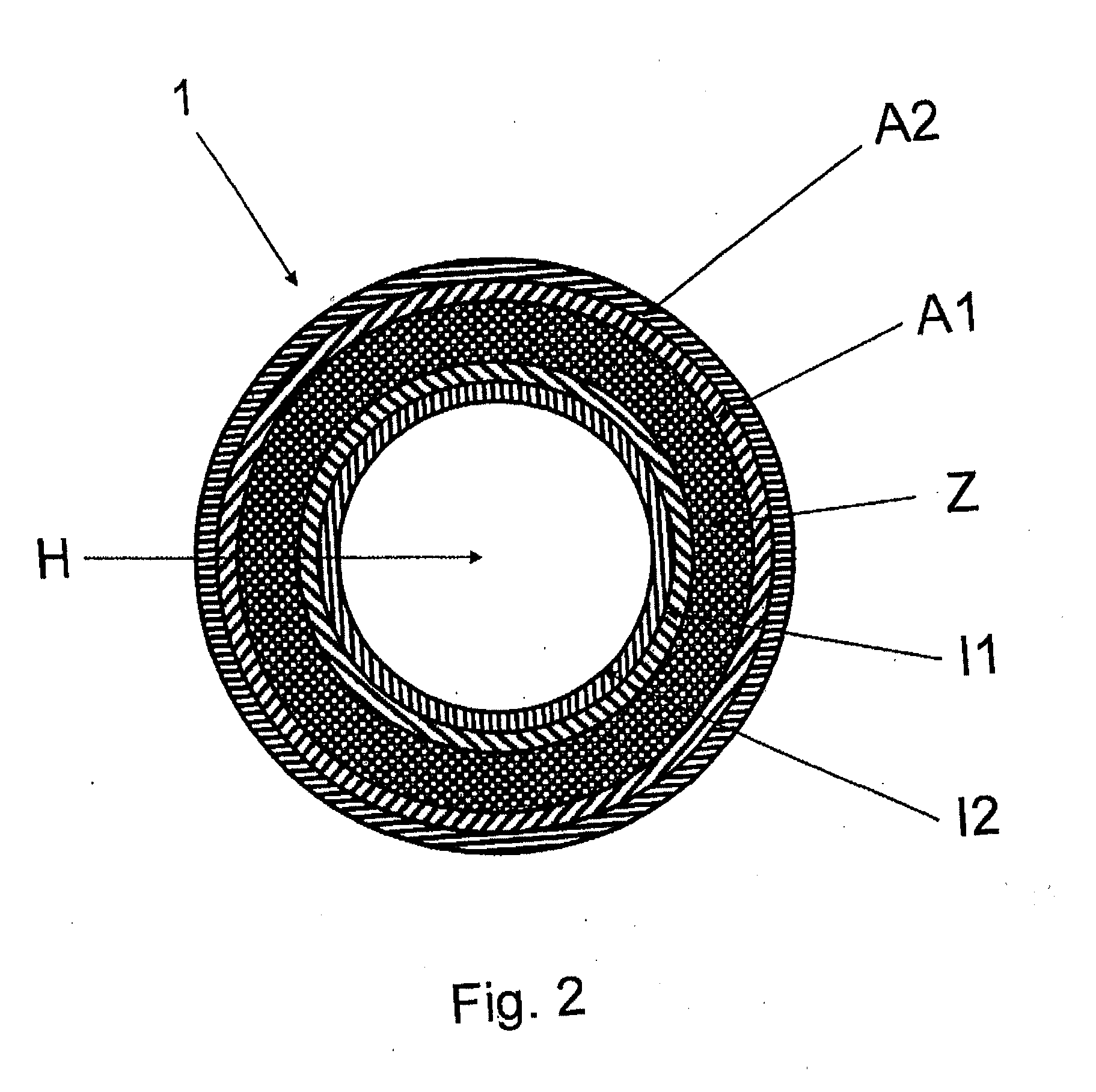 Casing body