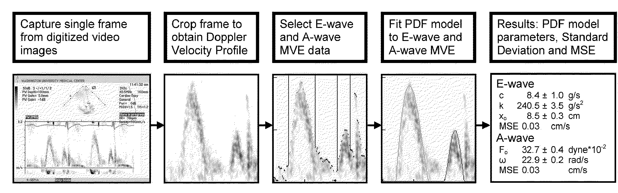 Load independent index of diastolic function