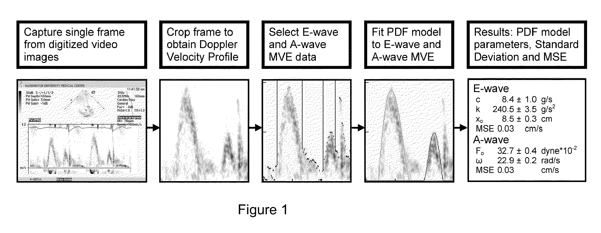 Load independent index of diastolic function