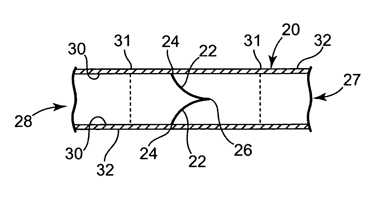 Composite heart valve apparatus manufactured using techniques involving laser machining of tissue