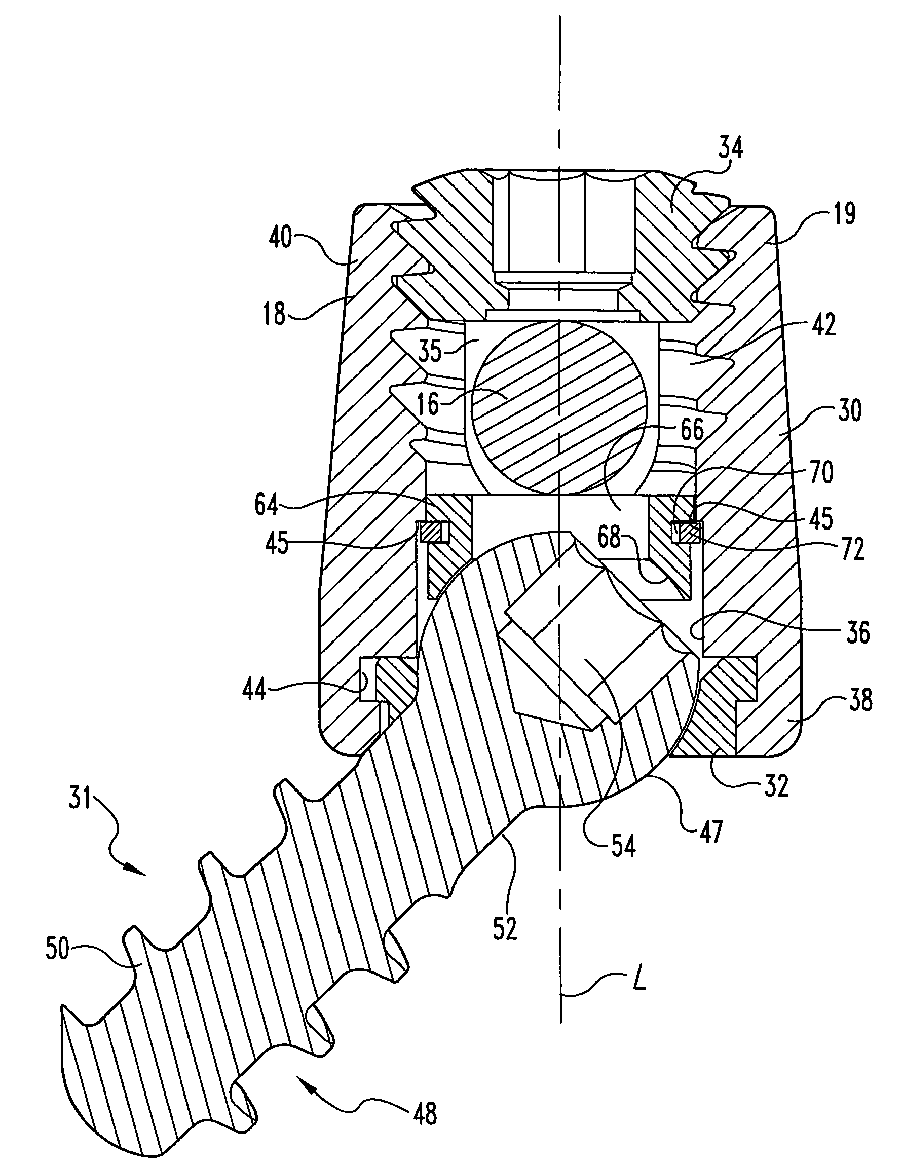 Multi-axial orthopedic device and system