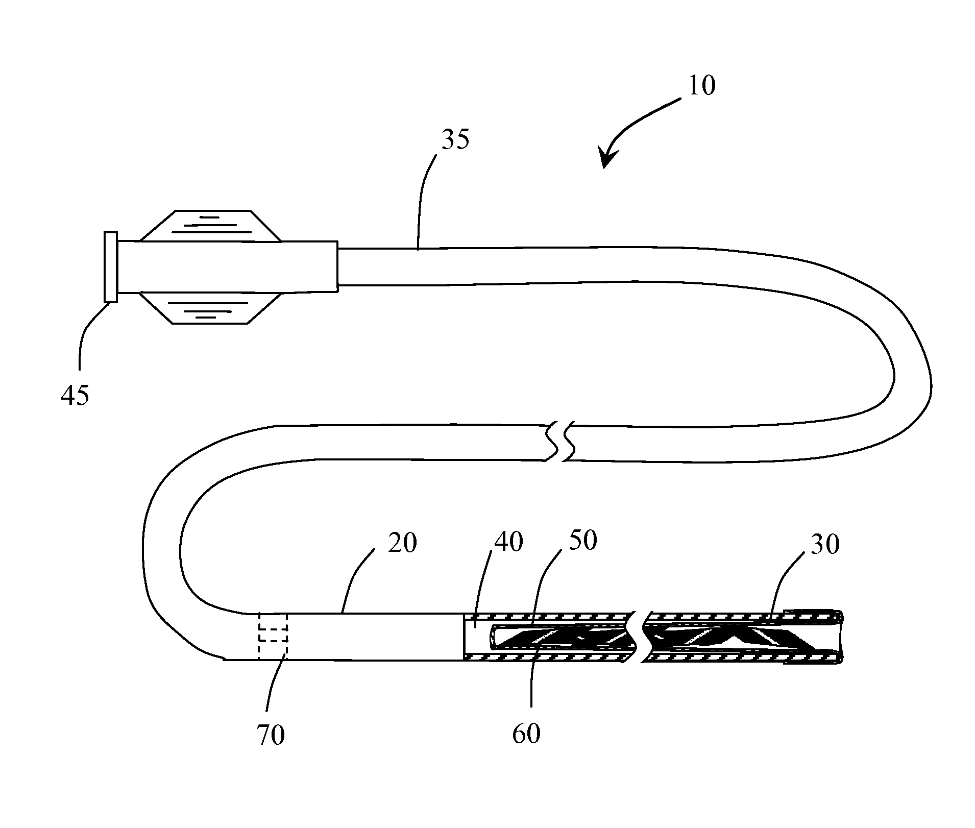 Systems for performing intralumenal reconstruction