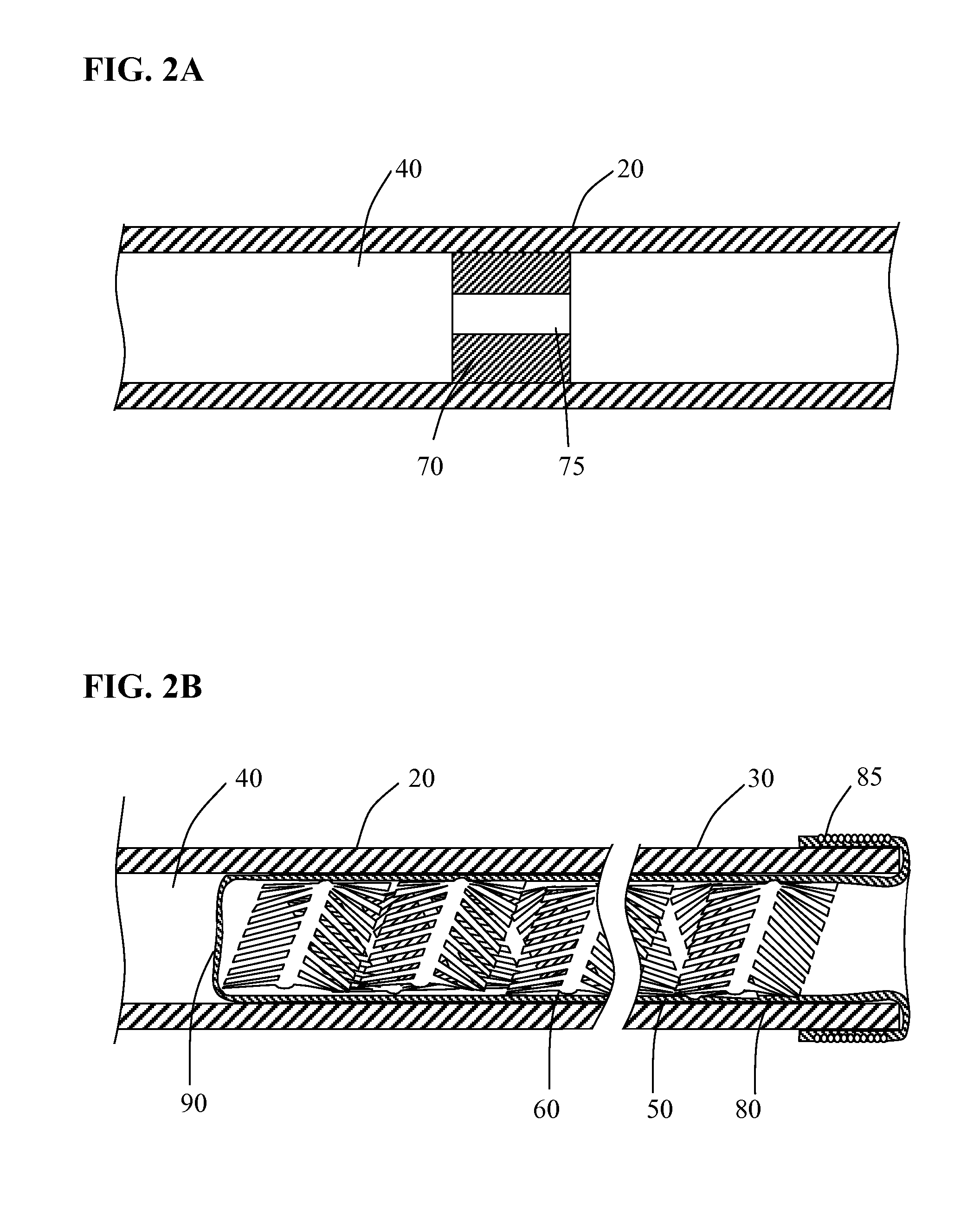 Systems for performing intralumenal reconstruction