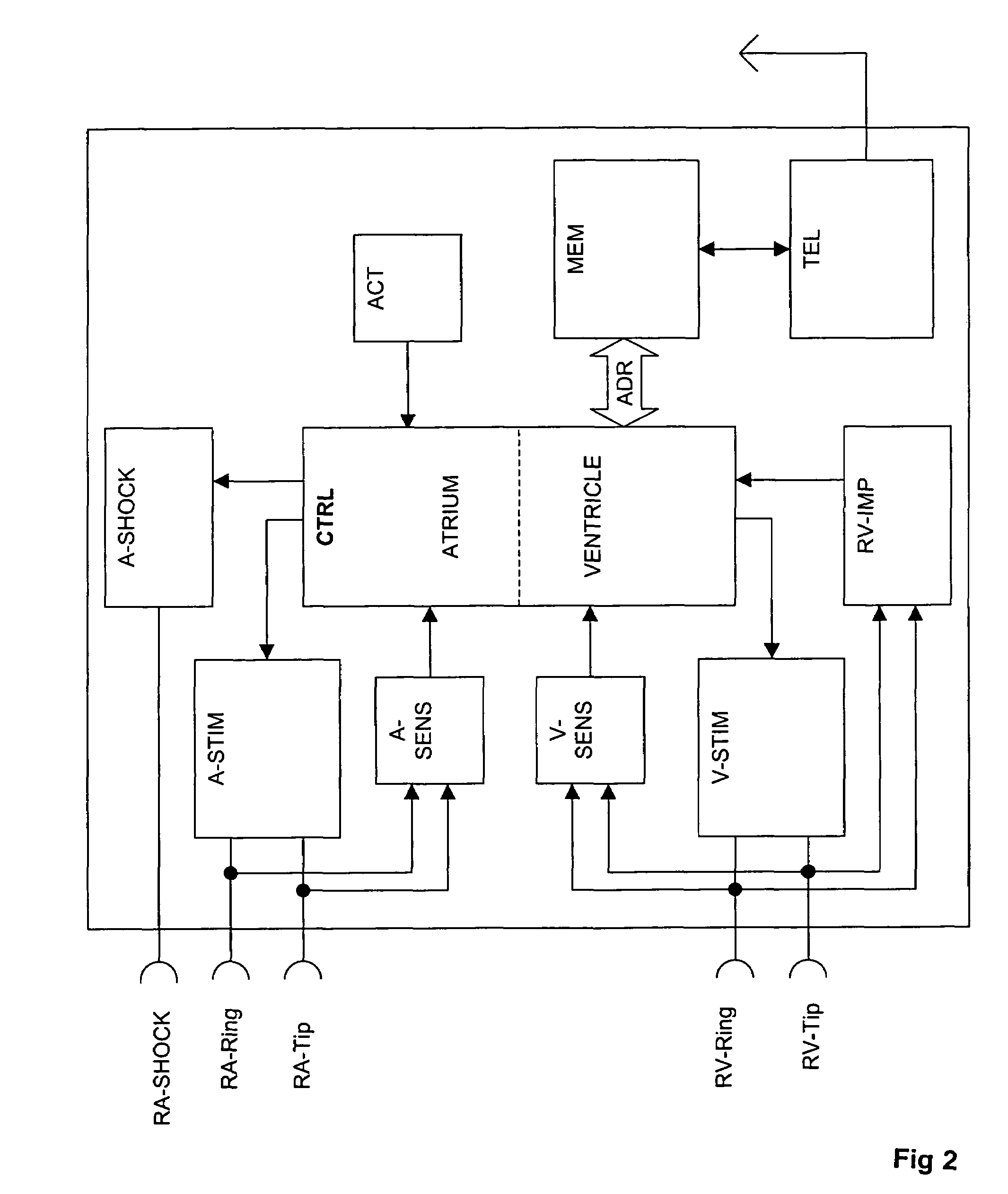 Atrial defibrillator