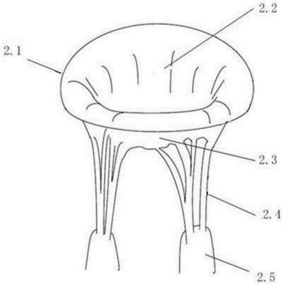 Strut type bicuspid valve airbag closing plate obstruction body implanted through cardiac apex, and implantation method thereof