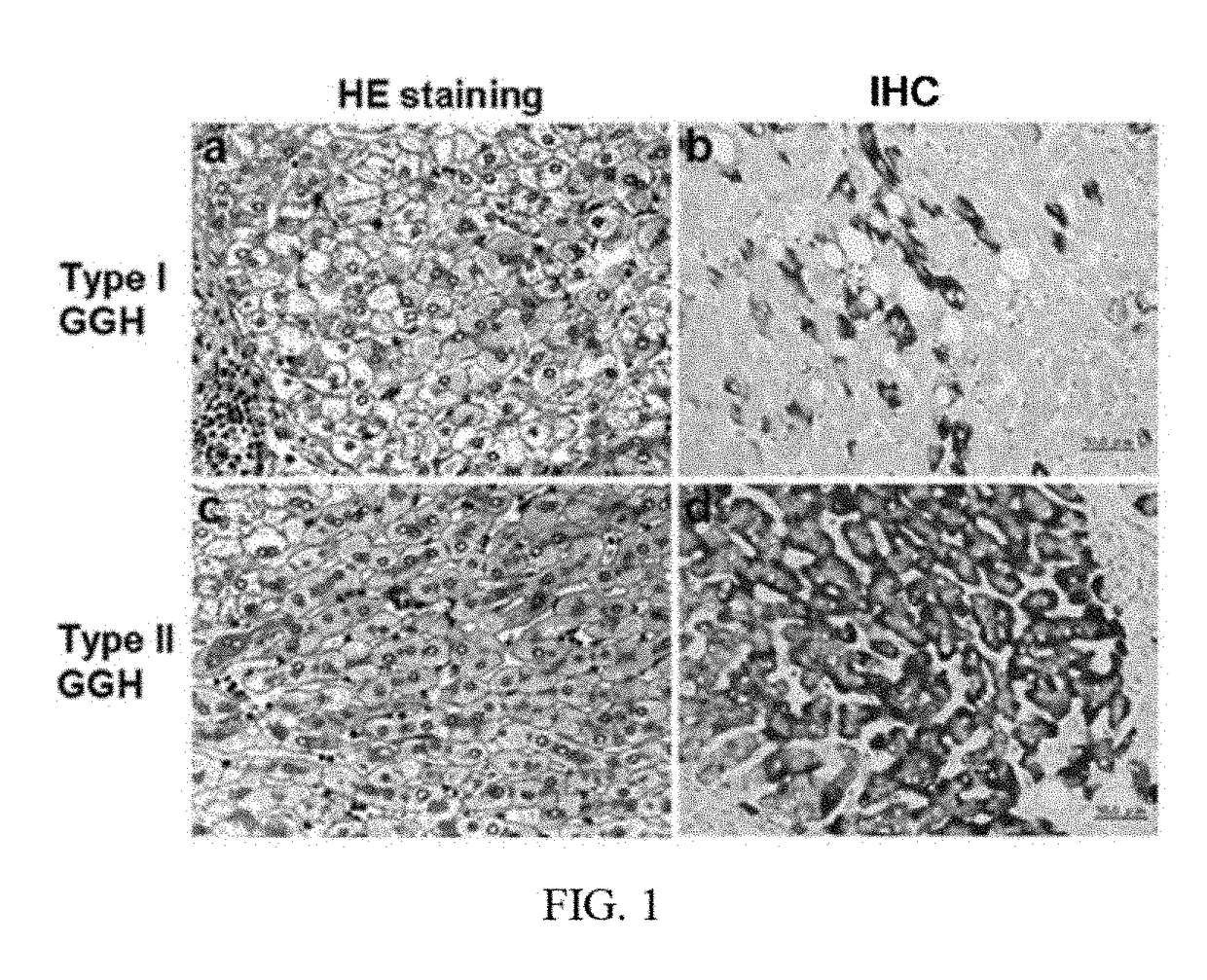 Method for determining deletions in HBV pre-s2 region