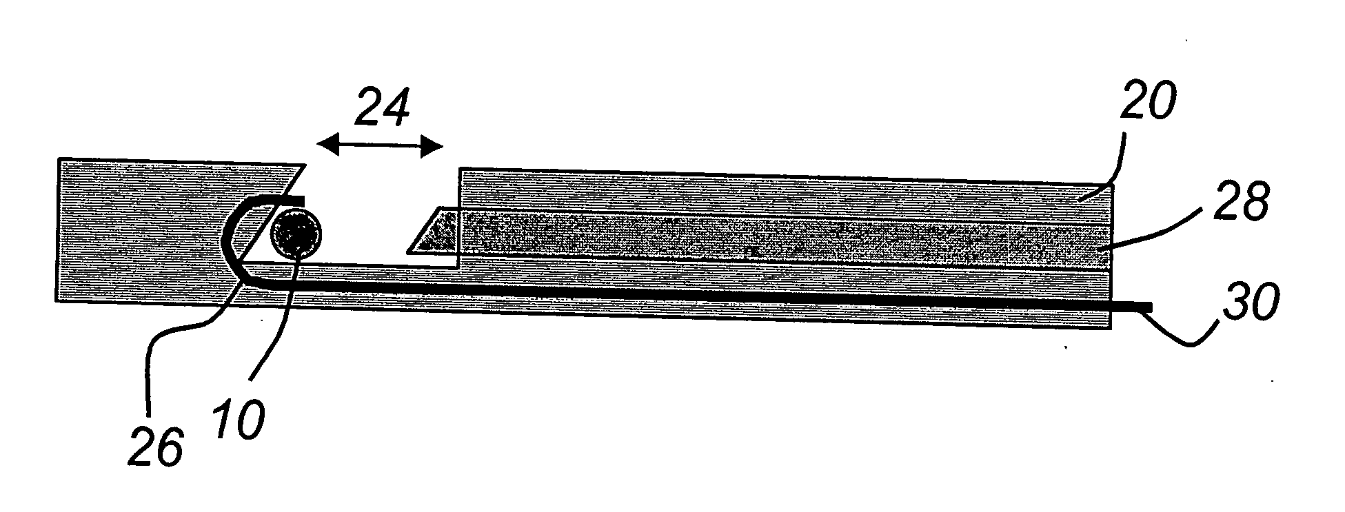 Cardiac devices and methods for minimally invasive repair of ischemic mitral regurgitation