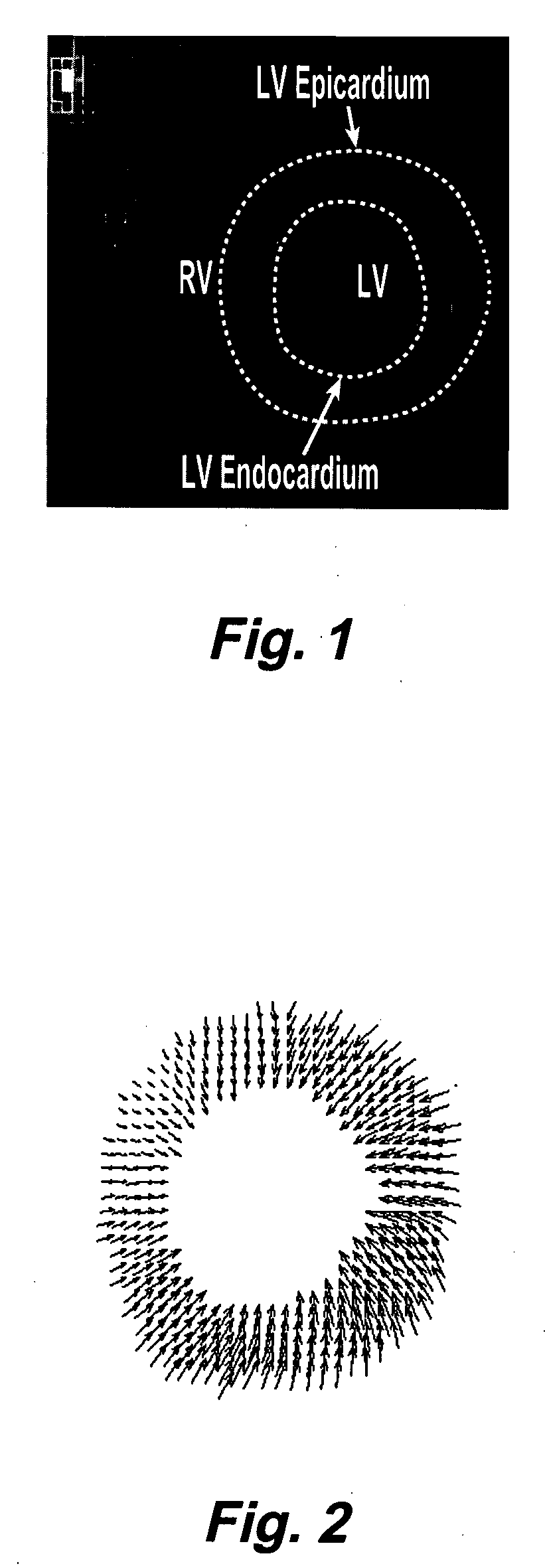 Motion-guided segmentation for cine dense images