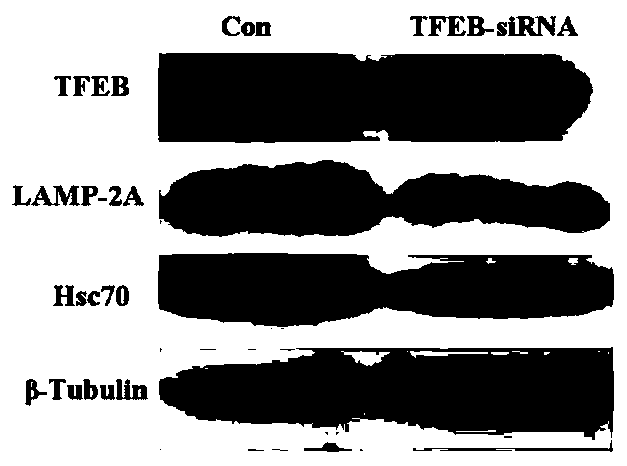 Short chain polypeptide capable of promoting TFEB nuclear translocation, linear short chain polypeptide based on short chain polypeptide, and application of short chain polypeptide to alleviating cerebral ischemia damage