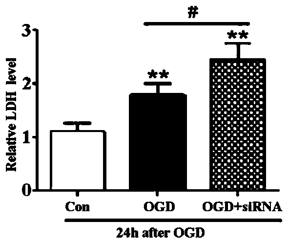 Short chain polypeptide capable of promoting TFEB nuclear translocation, linear short chain polypeptide based on short chain polypeptide, and application of short chain polypeptide to alleviating cerebral ischemia damage