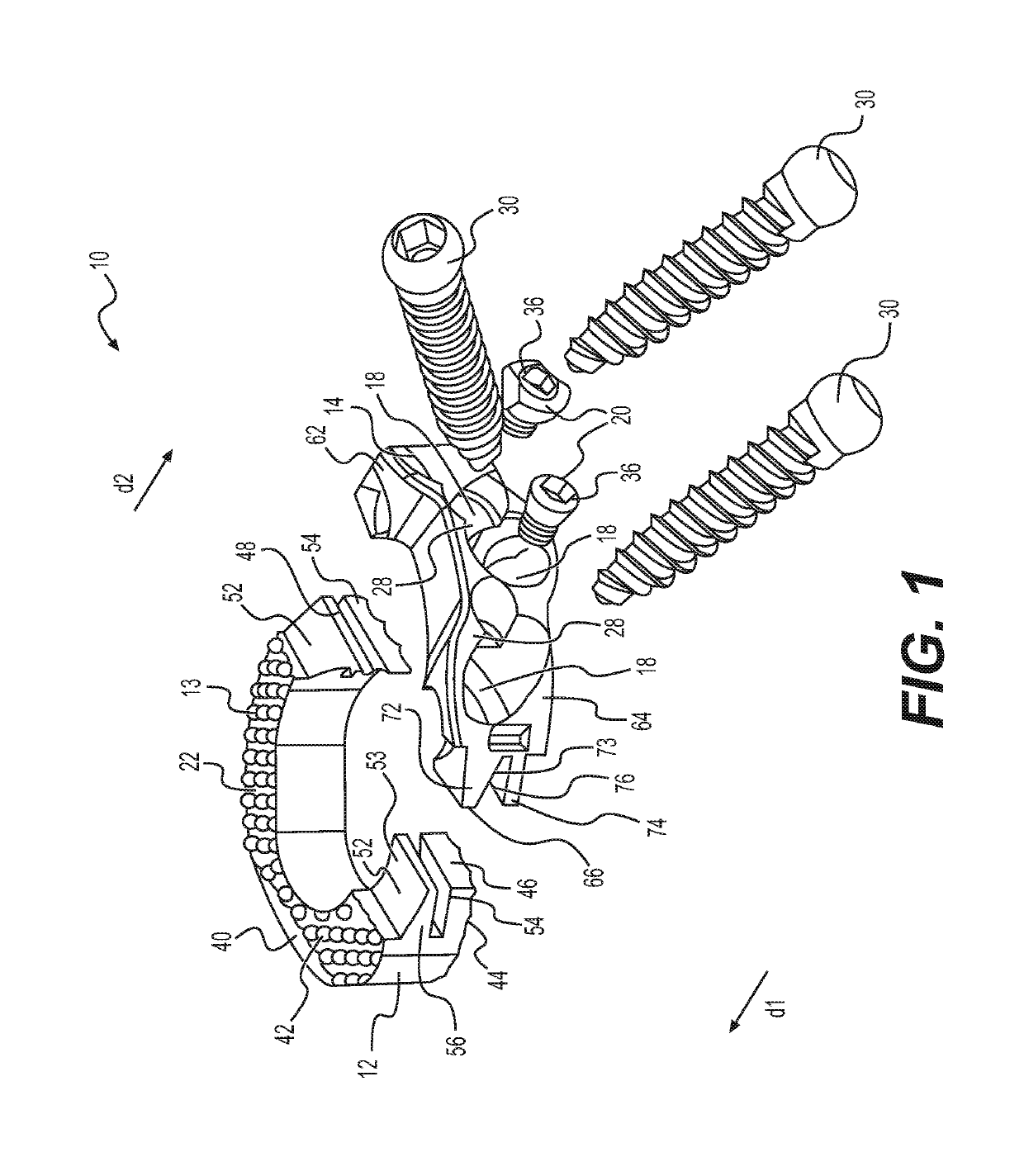 Interbody standalone intervertebral implant