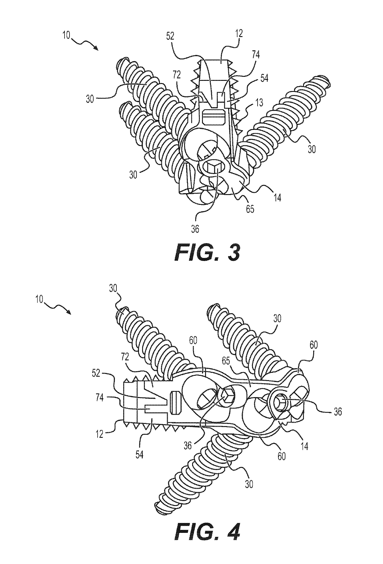 Interbody standalone intervertebral implant