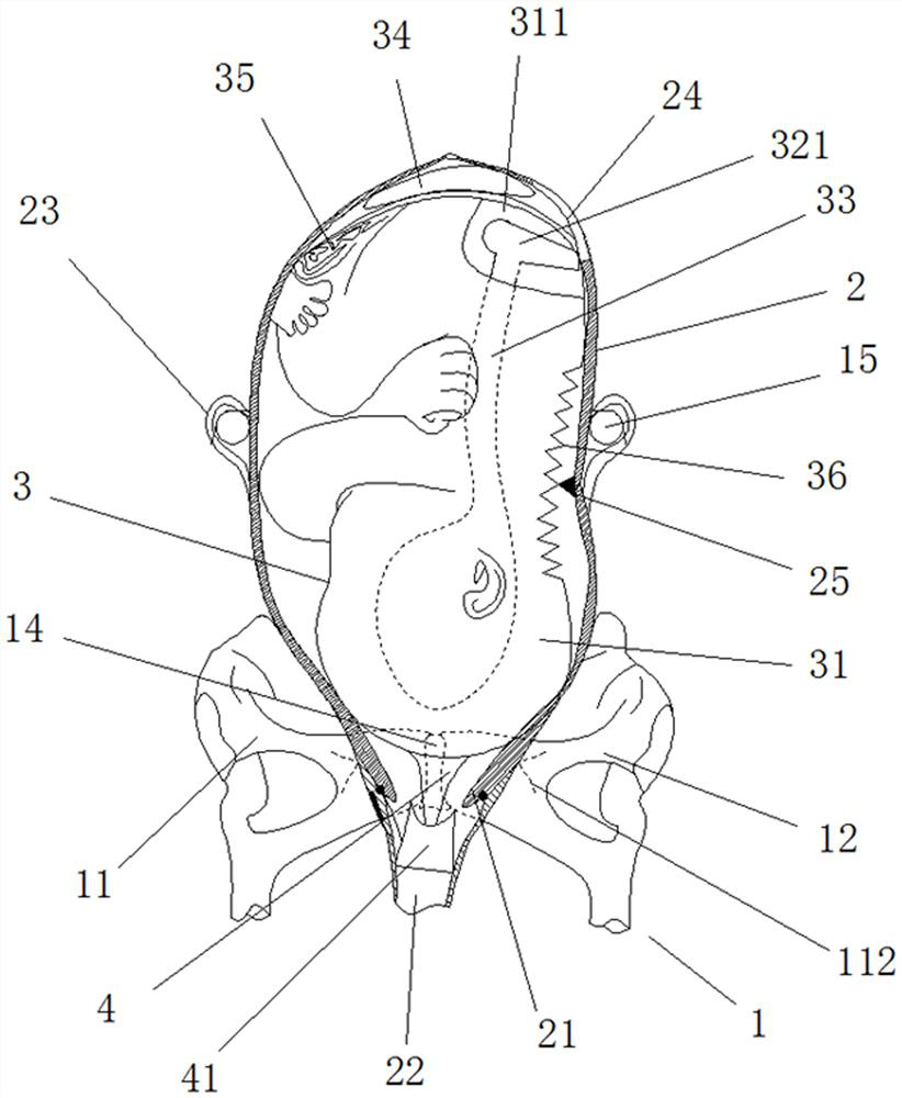 Pregnant and lying-in woman vagina examination teaching mold and using method thereof