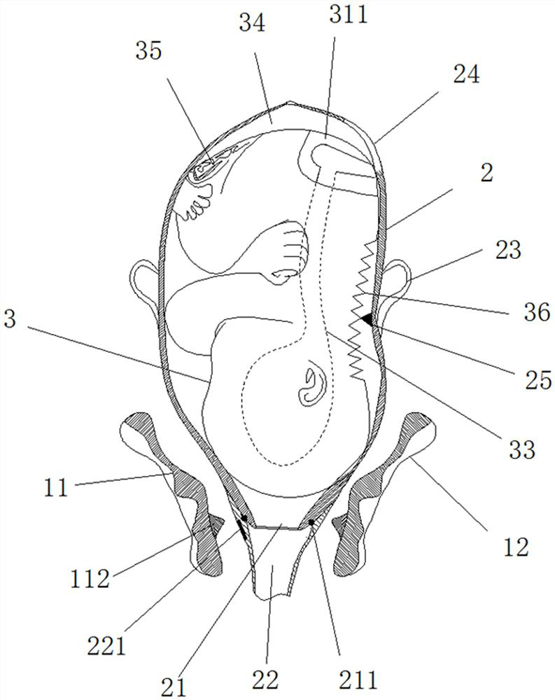 Pregnant and lying-in woman vagina examination teaching mold and using method thereof