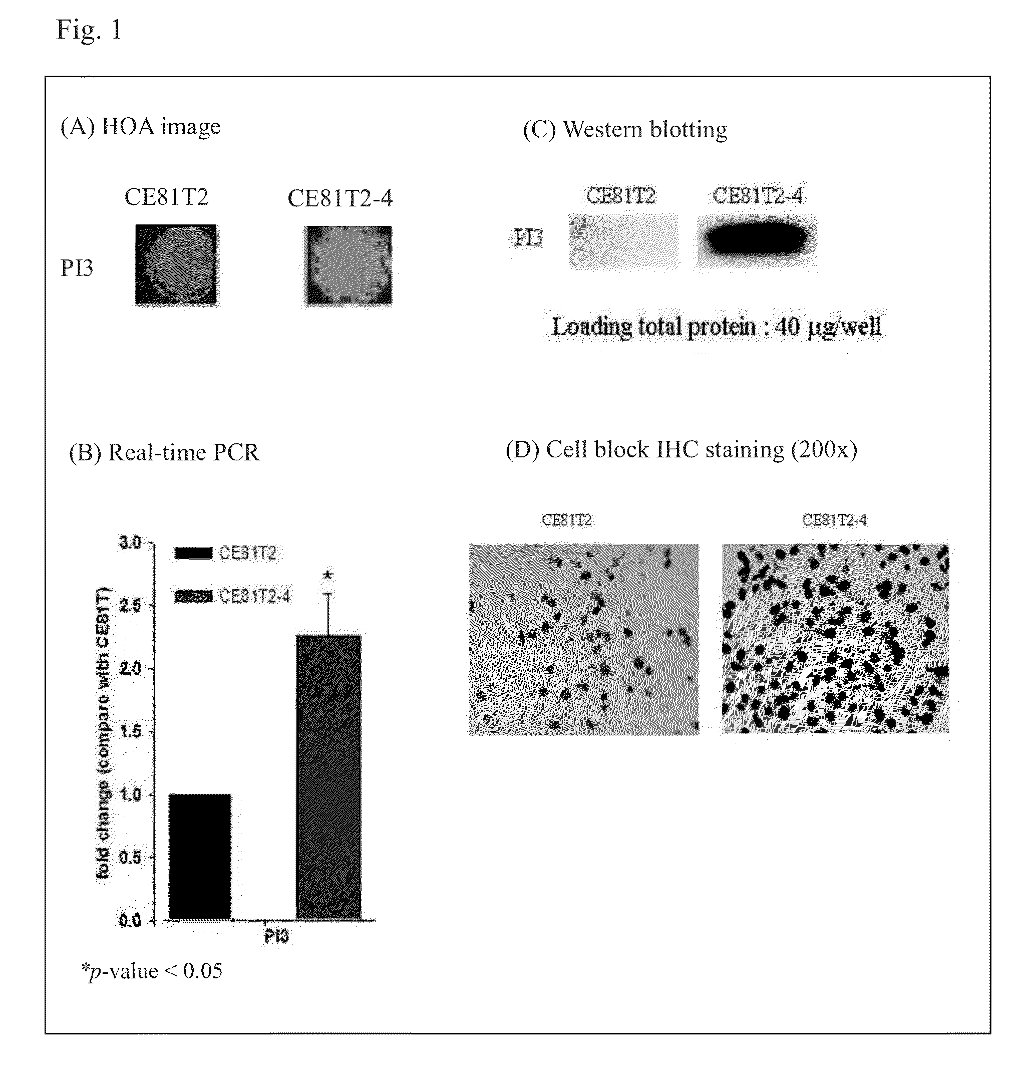 Method for predicting the survival status and prognosis of esophageal cancer and a kit thereof