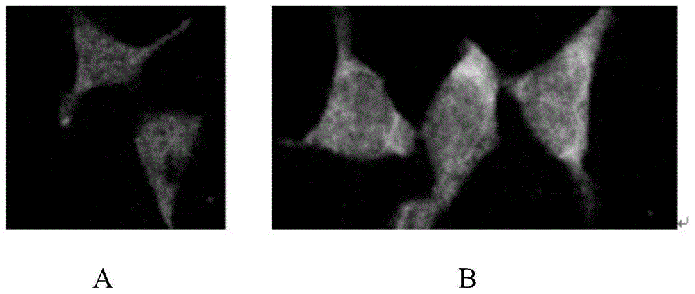 Recombinant adeno-associated virus-NADH dehydrogenase sigmasubunit 4 gene total length for treating Leber hereditary optic neuropathy and medicament