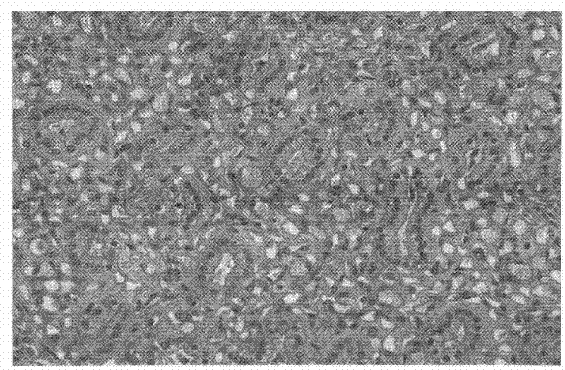 Formaldehyde-free fixative for tissue sample