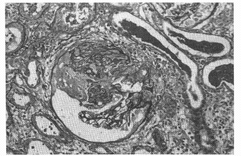 Formaldehyde-free fixative for tissue sample