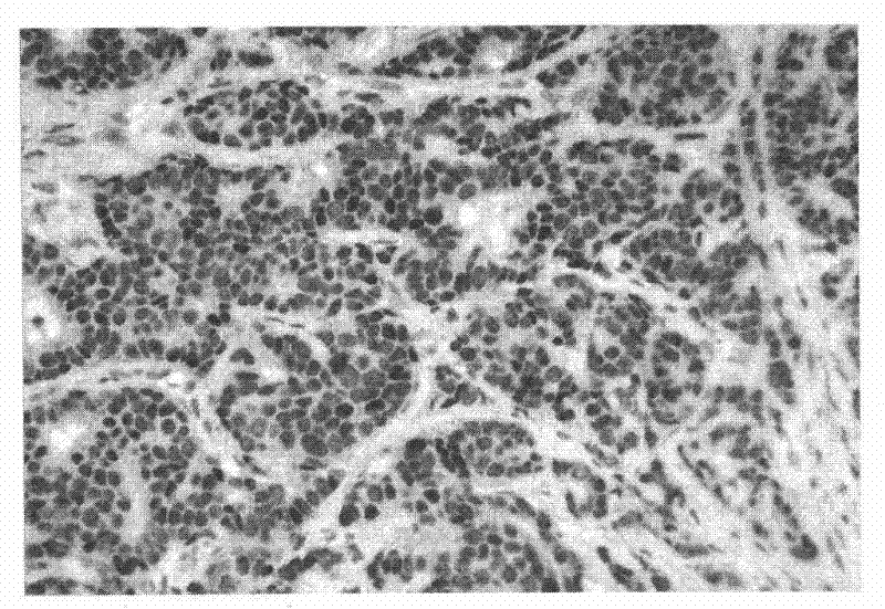 Formaldehyde-free fixative for tissue sample