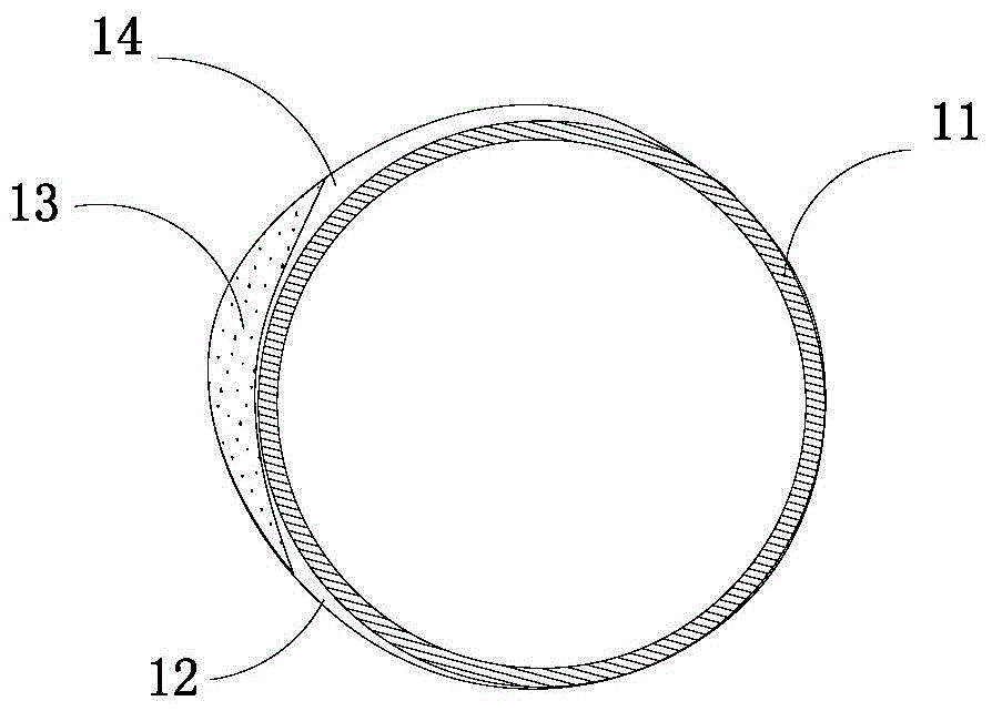 Lumen stent